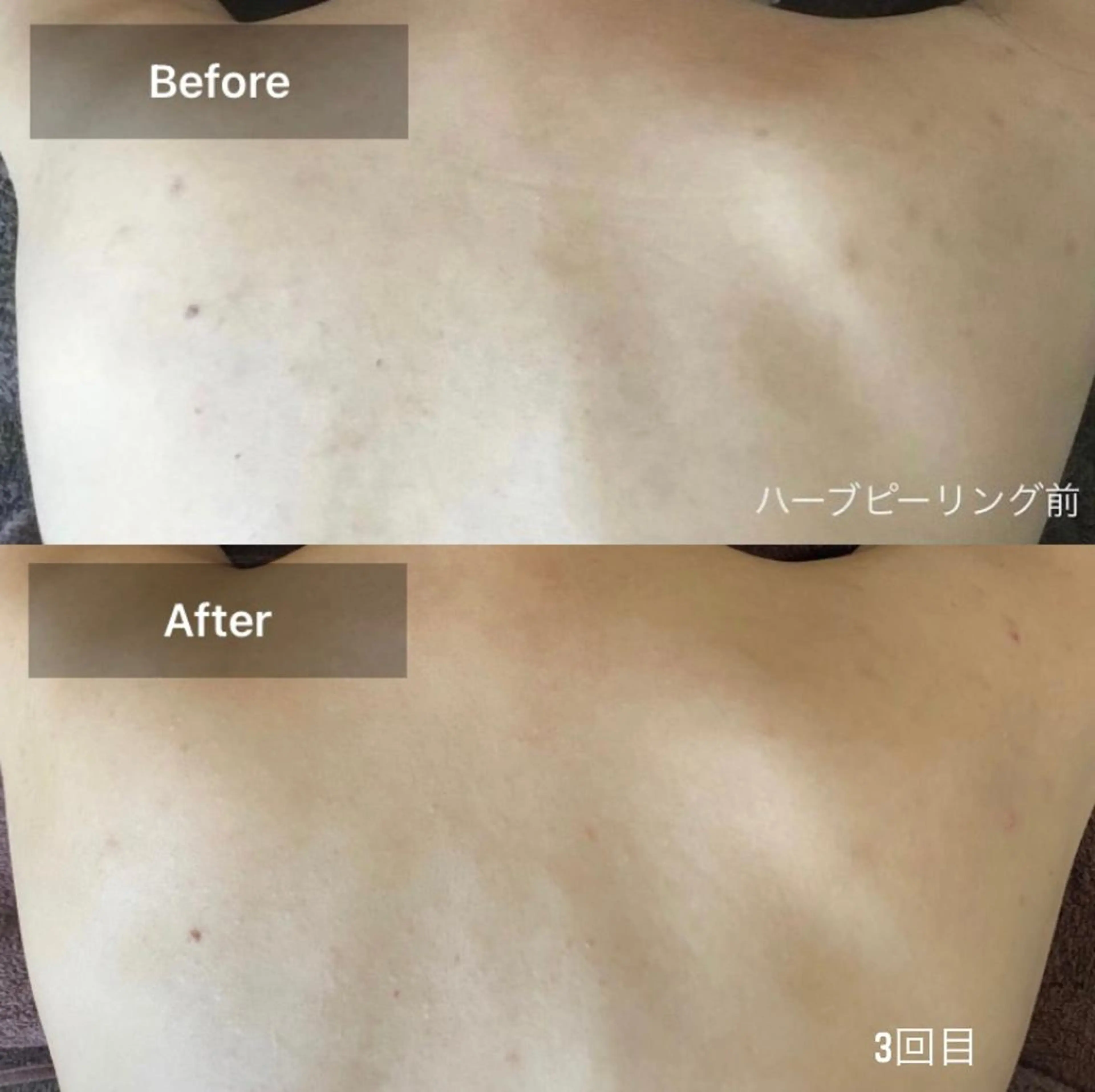 エステ 美肌・リラクゼーションサロンLu,Mie所属・美肌と癒しのサロン Lu,Mieのエステ・リラクイメージ