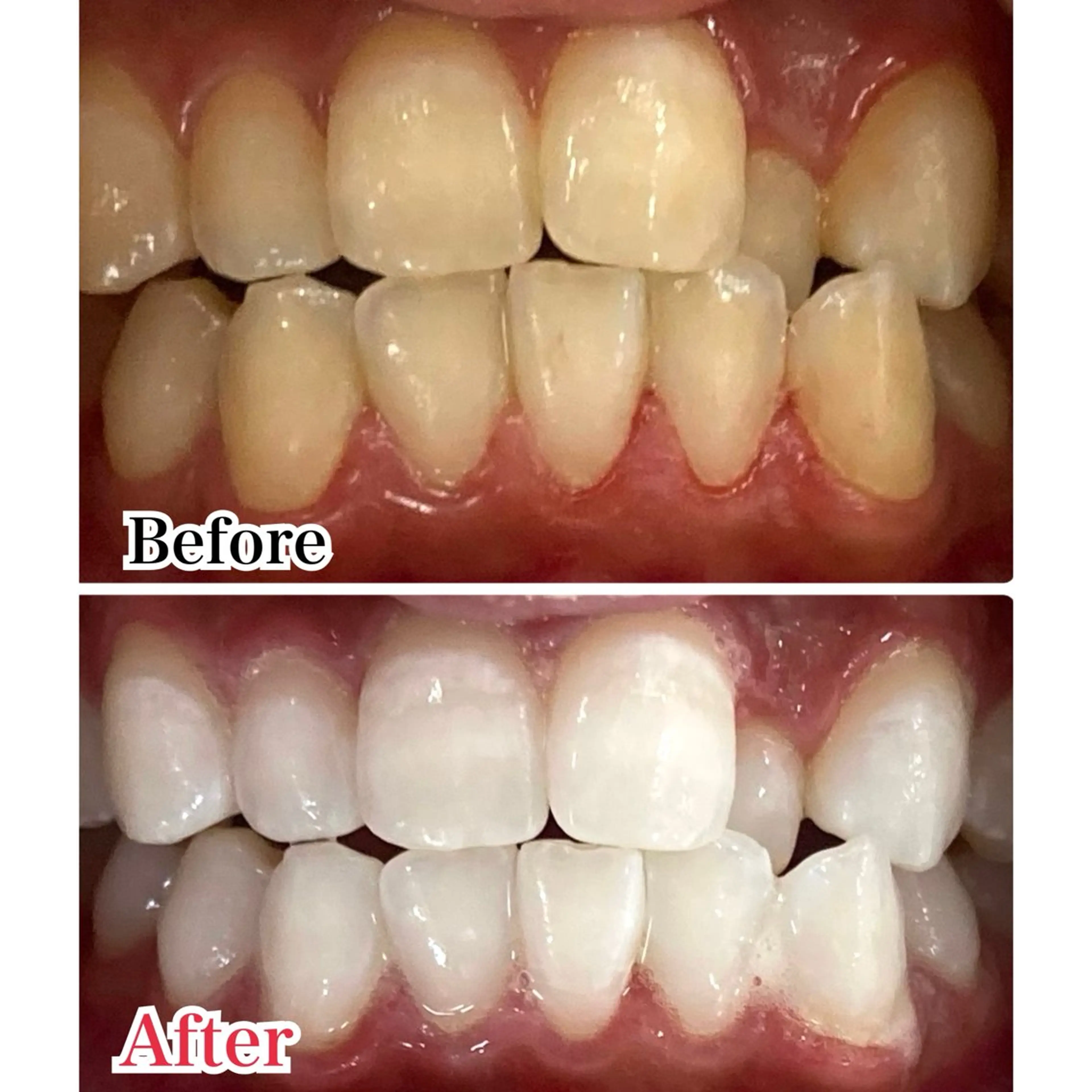 メンズ エステ 【歯科提携】柏ホワイ トニングスタイルのその他イメージ