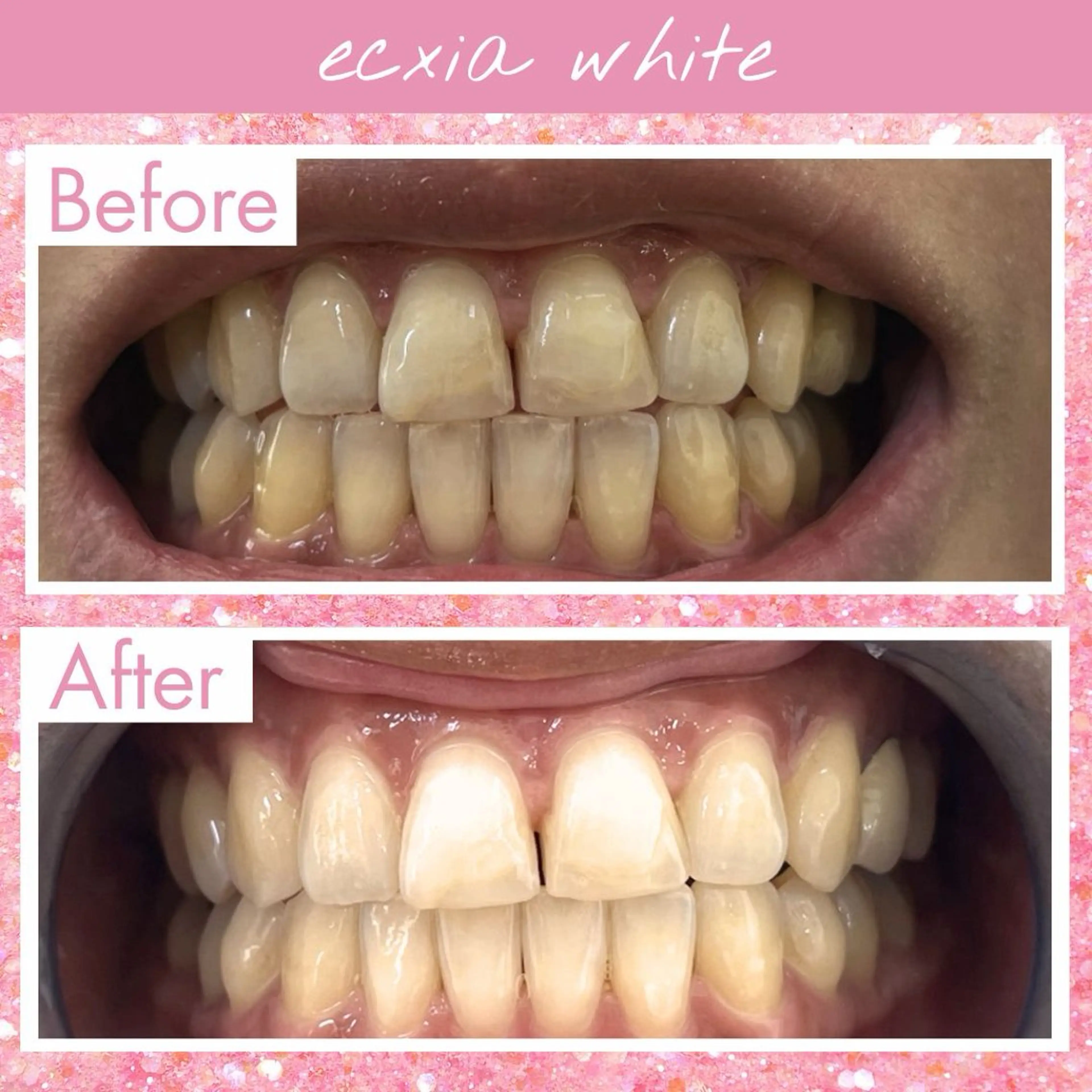 セルフホワイトニング エクシア泉中央店のその他イメージ