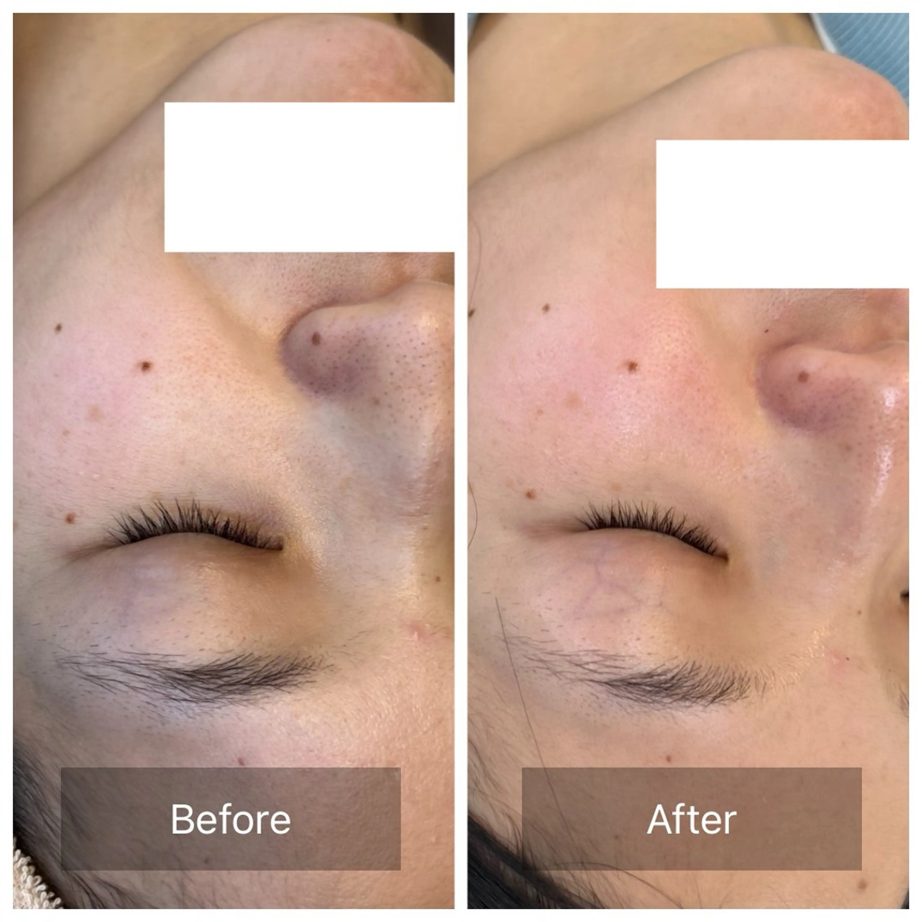 facial aesthetic salon SENTEUR所属・美肌改善/毛穴/シミ サントゥールのエステ・リラクイメージ