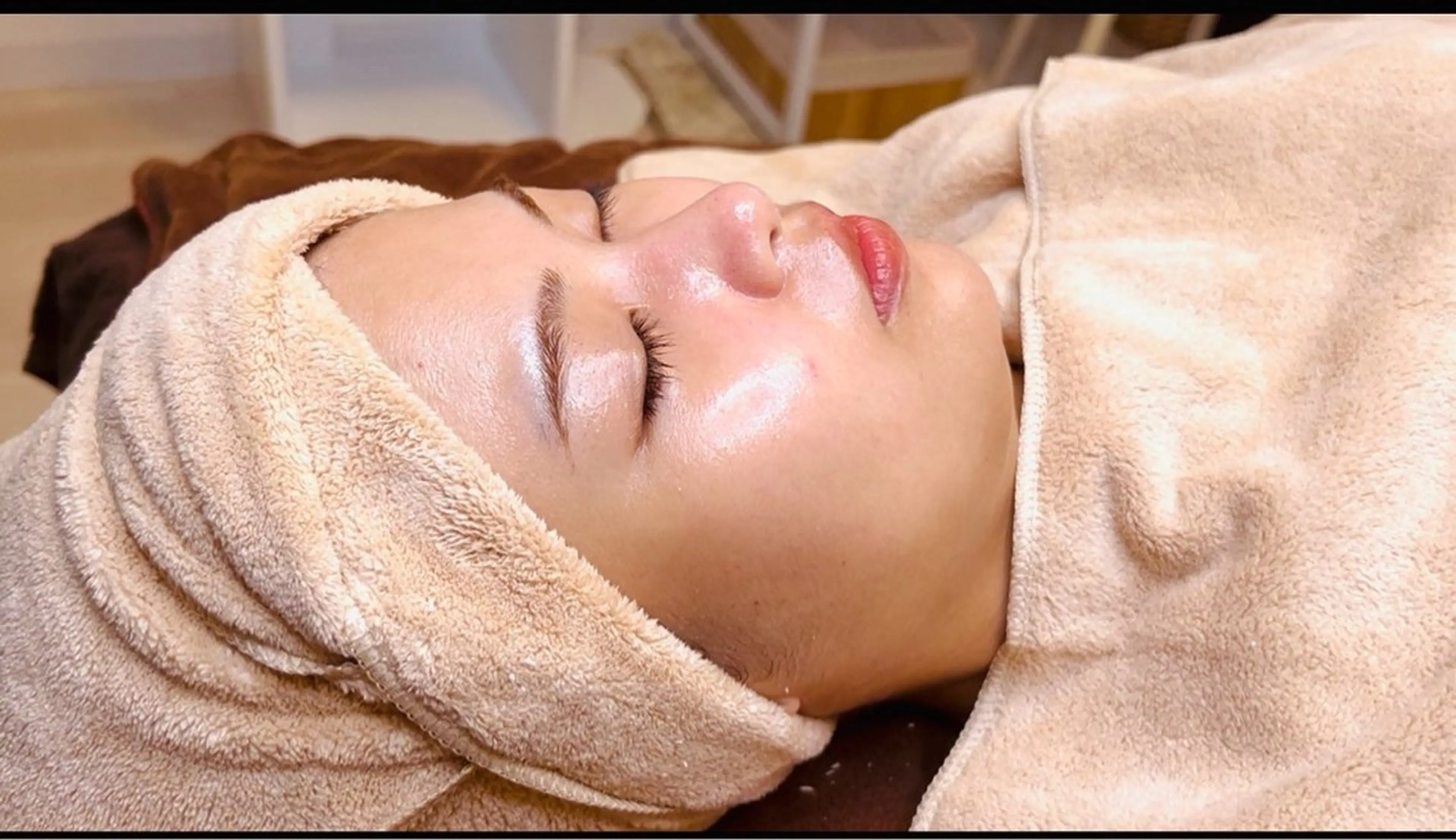 【ツヤ肌ピーリング9,900円】韓国女優ツヤ肌への近道はラレステンだけ！！剥離なし敏感肌の方にも◎の写真