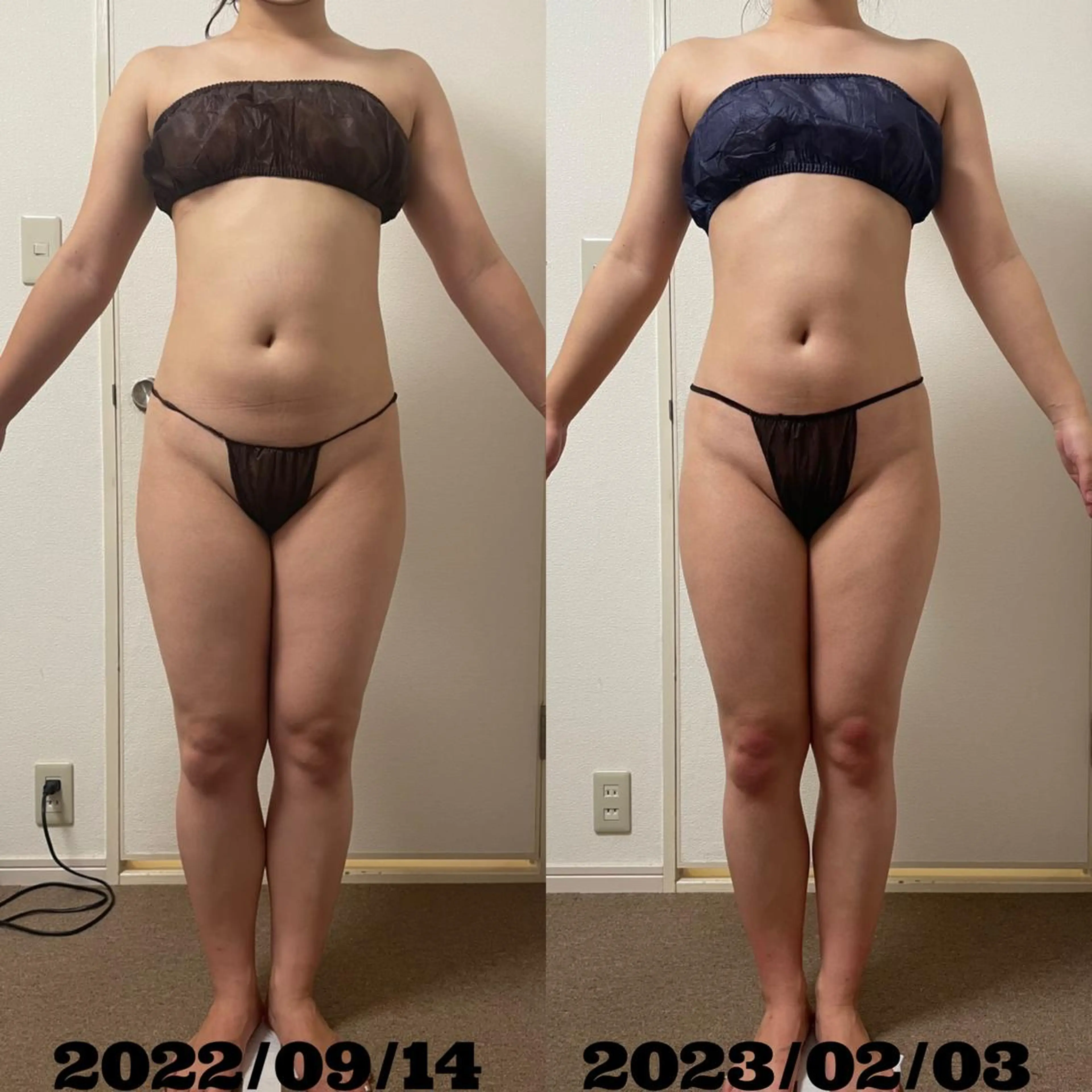 Linomalie エステ/たるみ/脱毛のエステ・リラクイメージ