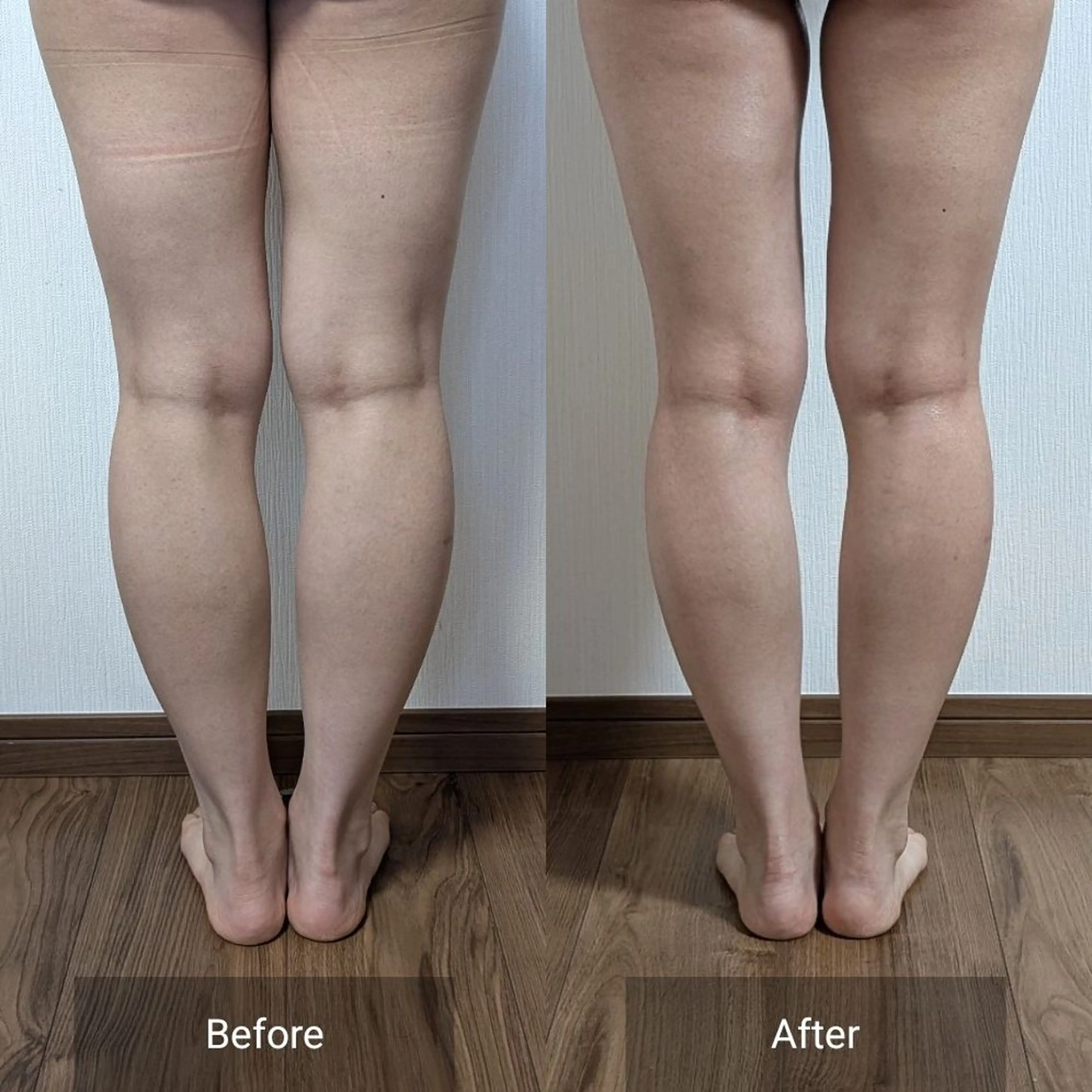 エステ nail RiRi アトレナチュラのエステ・リラクイメージ