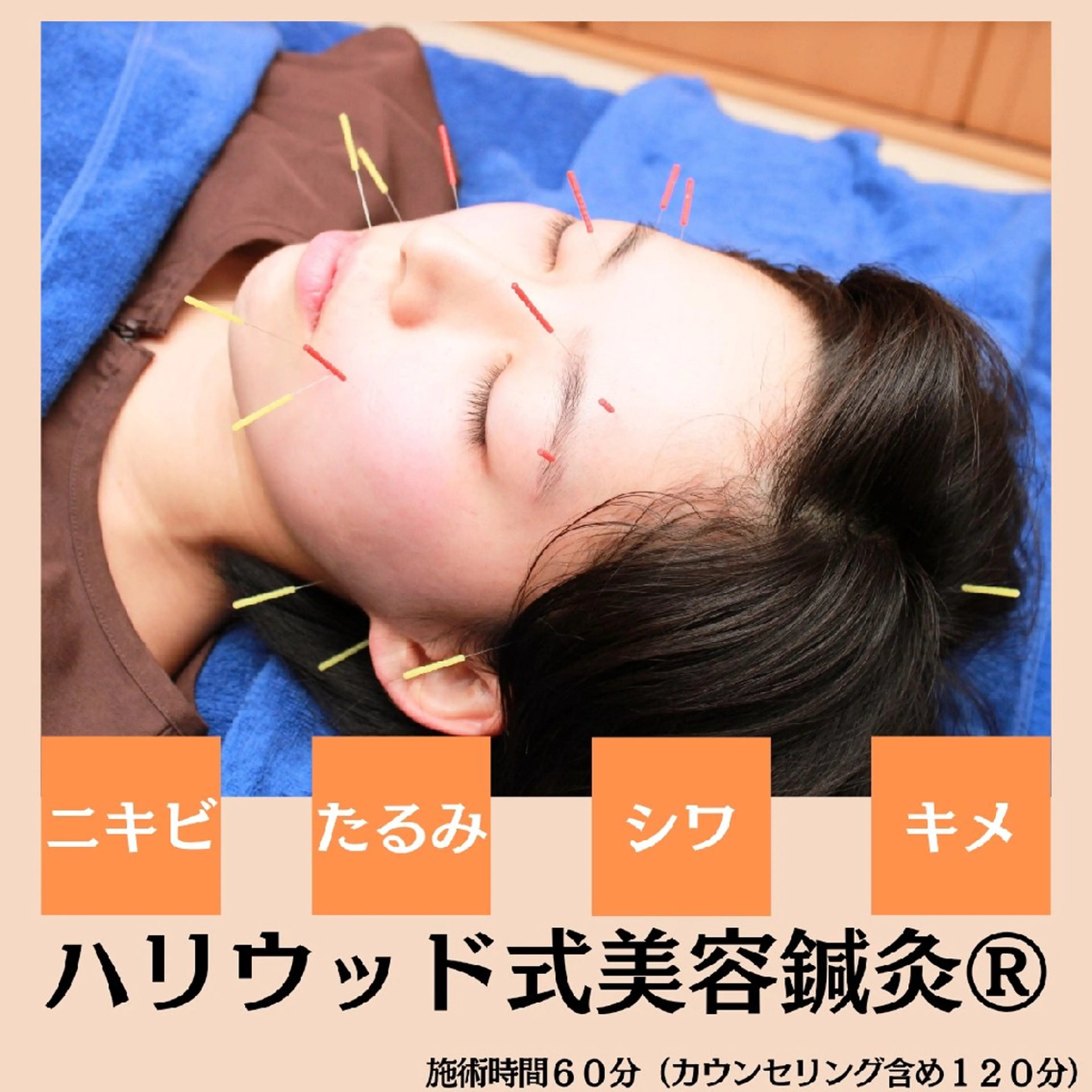 【新規限定】肌質改善★美容鍼灸(60分コース)の写真