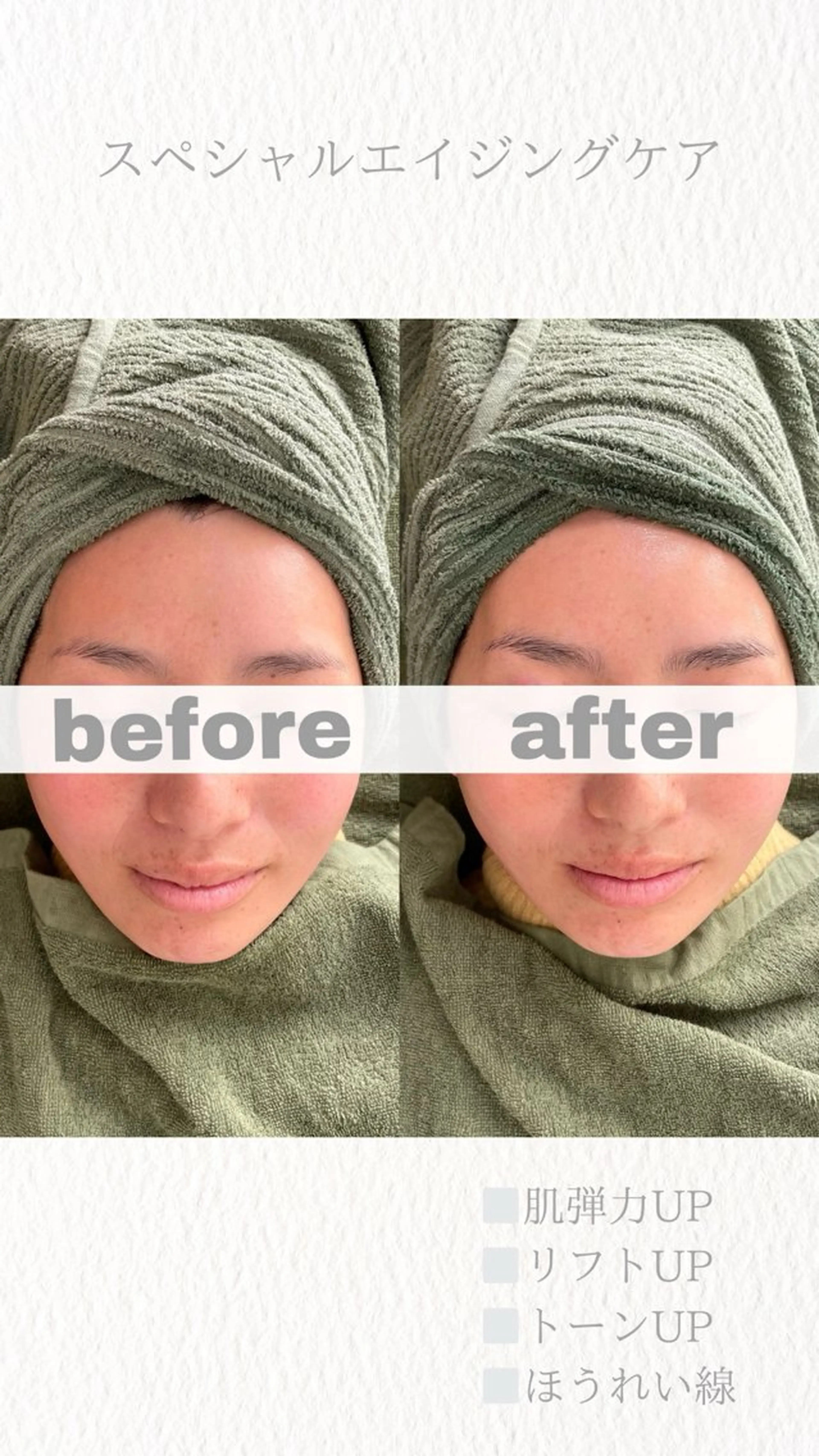 エステ uru.所属・林田 圭純のエステ・リラクイメージ