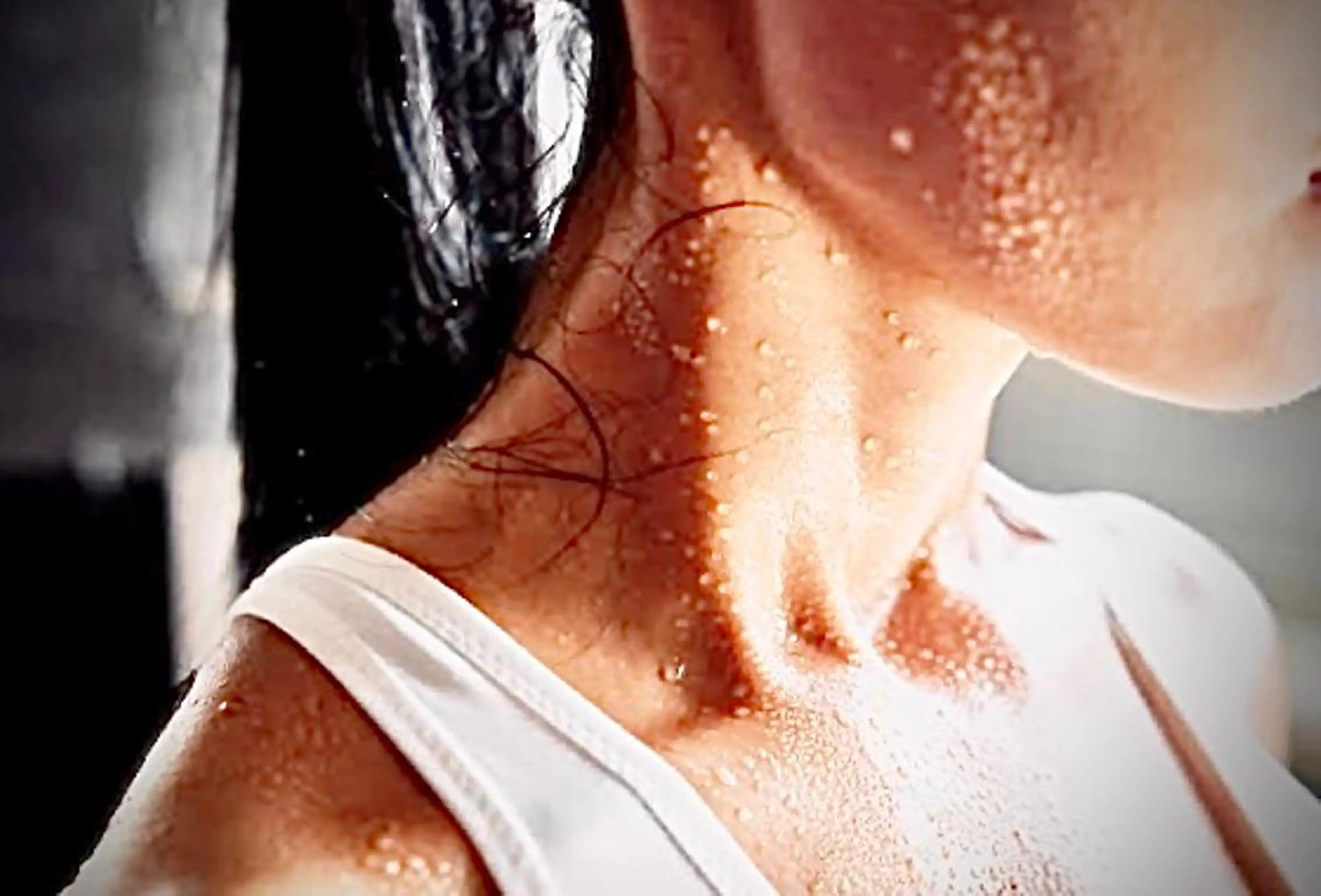 【痩身人気No.1❗️】徹底燃焼コースの写真