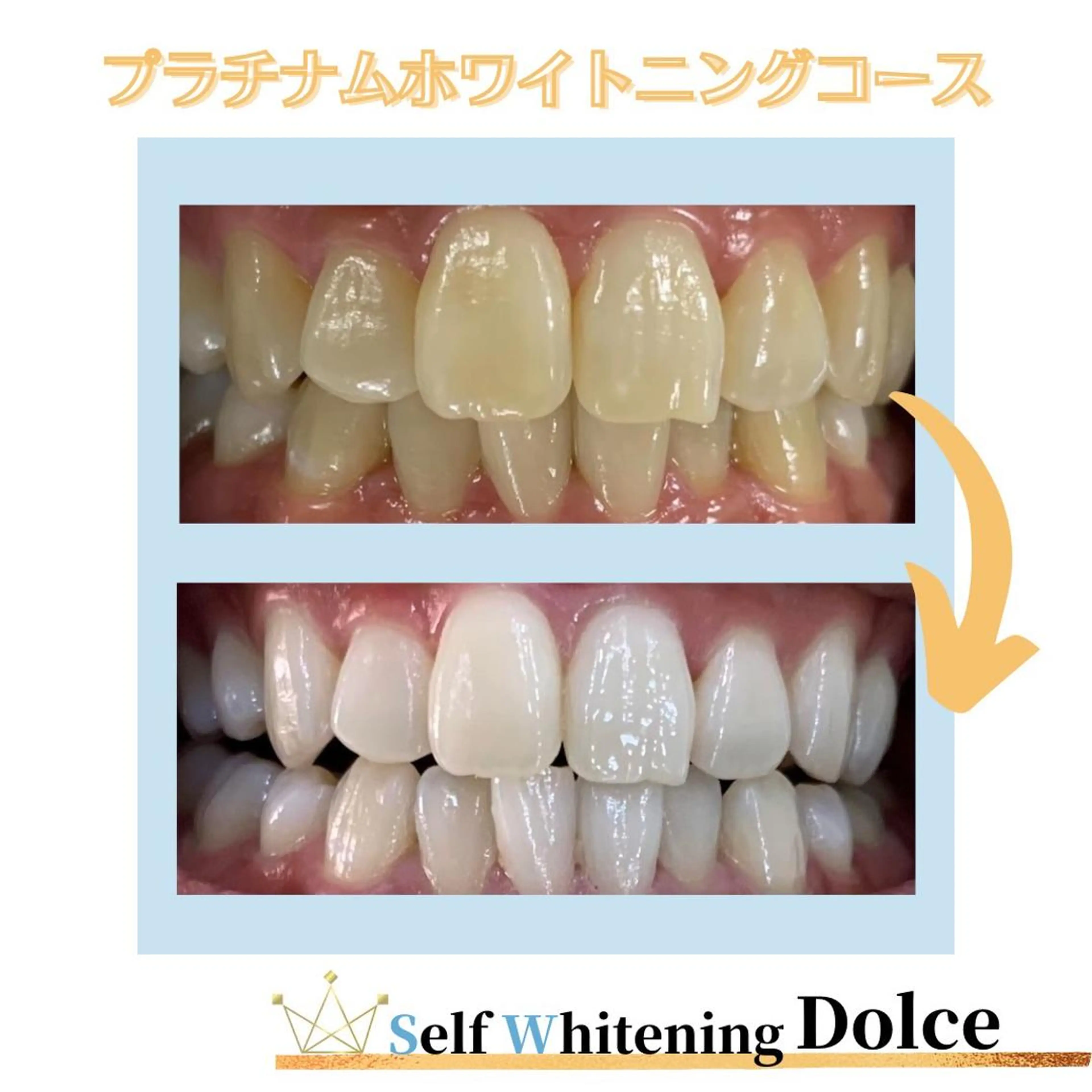 セルフホワイトニング Dolce八王子店のその他イメージ