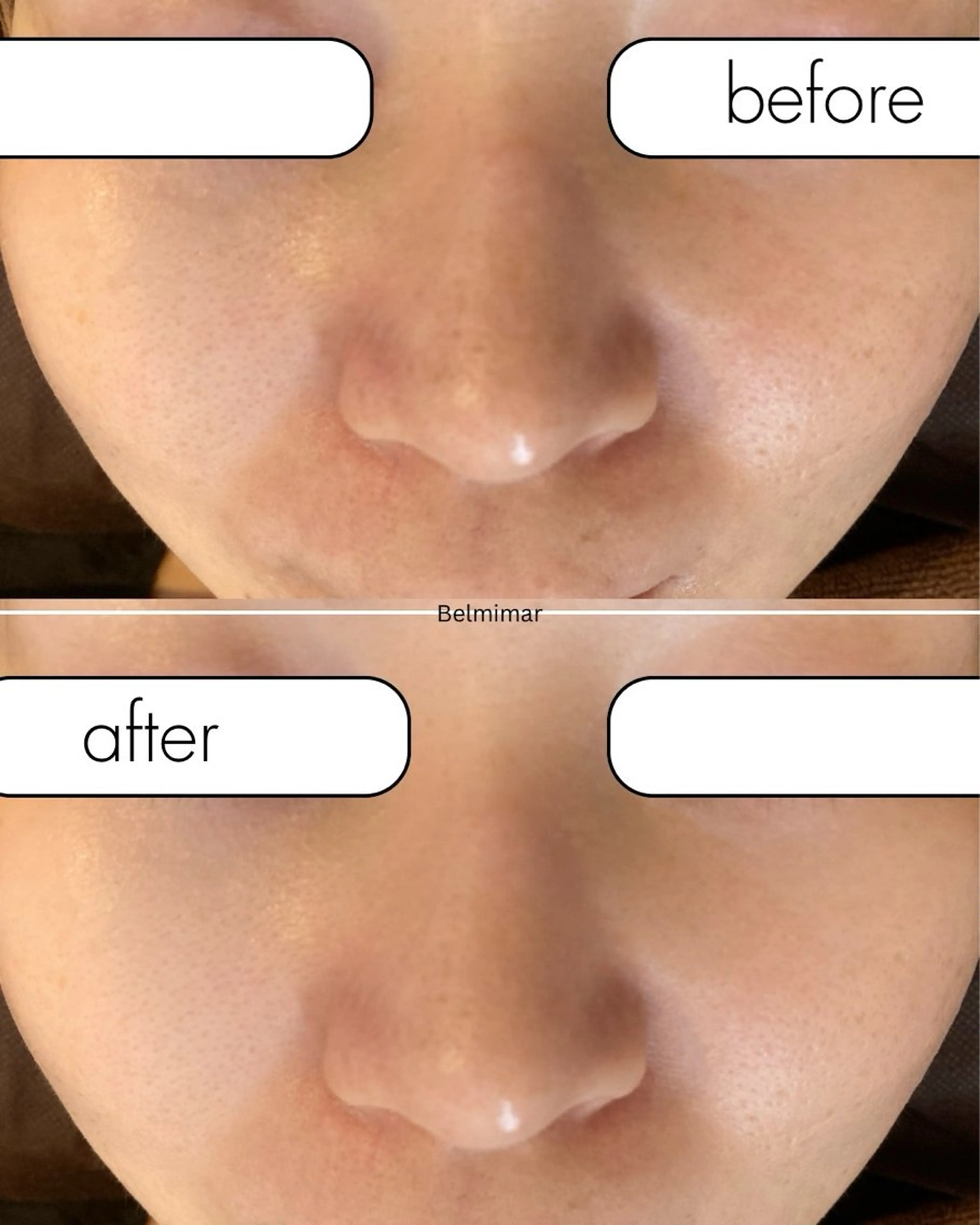 南森町・肌質改善 BELMIMARのエステ・リラクイメージ