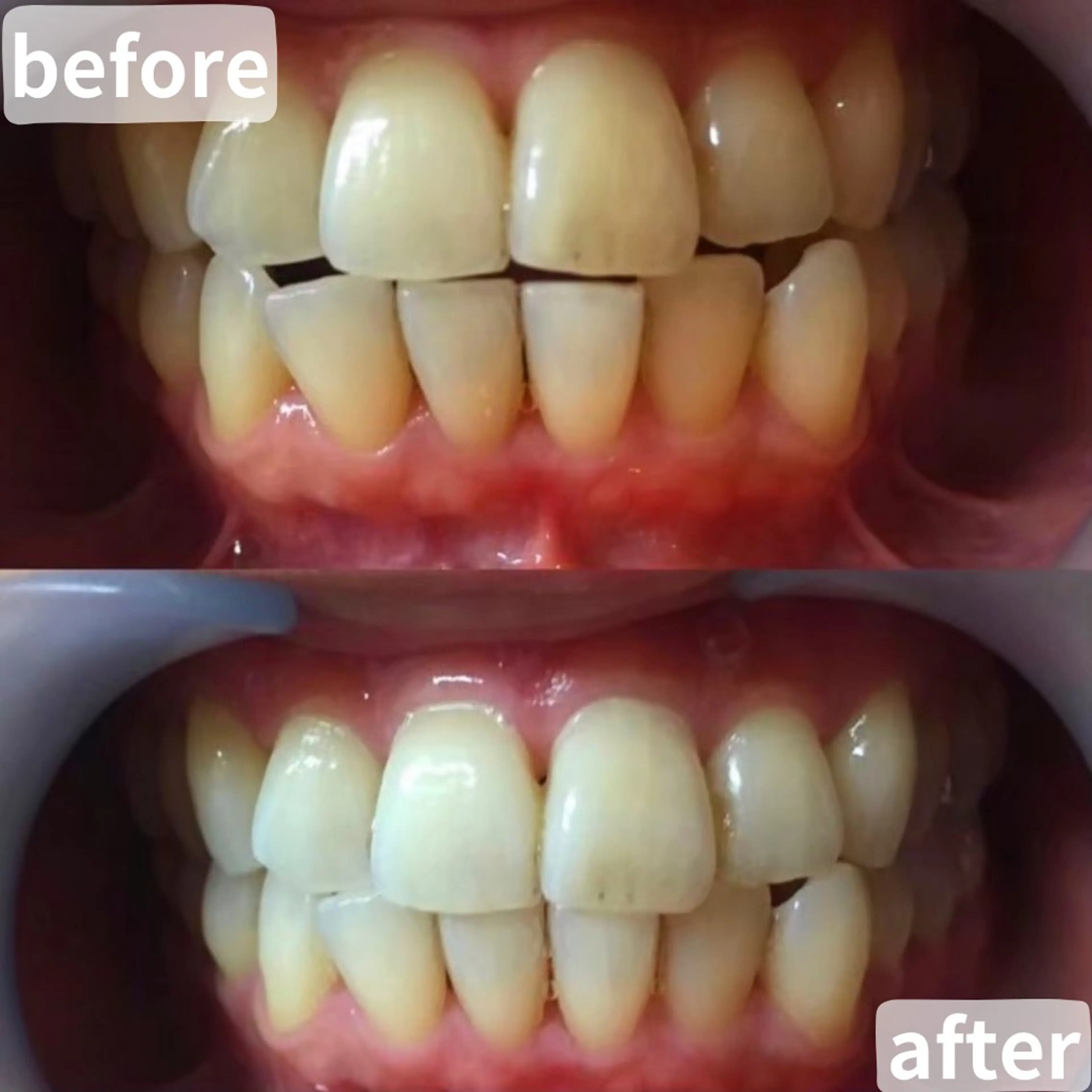 LBSホワイトニング 桶川店のエステ・リラクイメージ