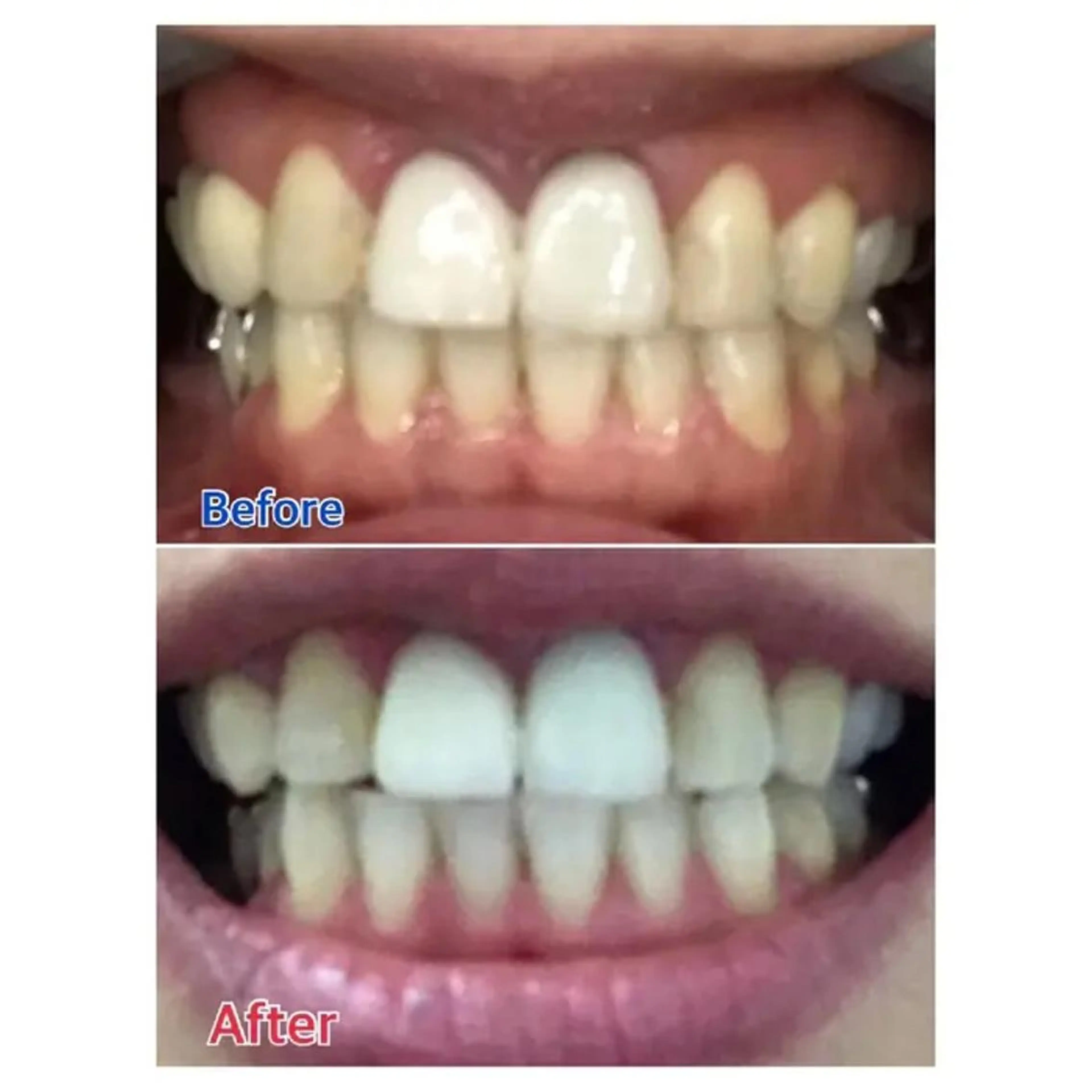 M渋谷 ホワイトニングのその他イメージ