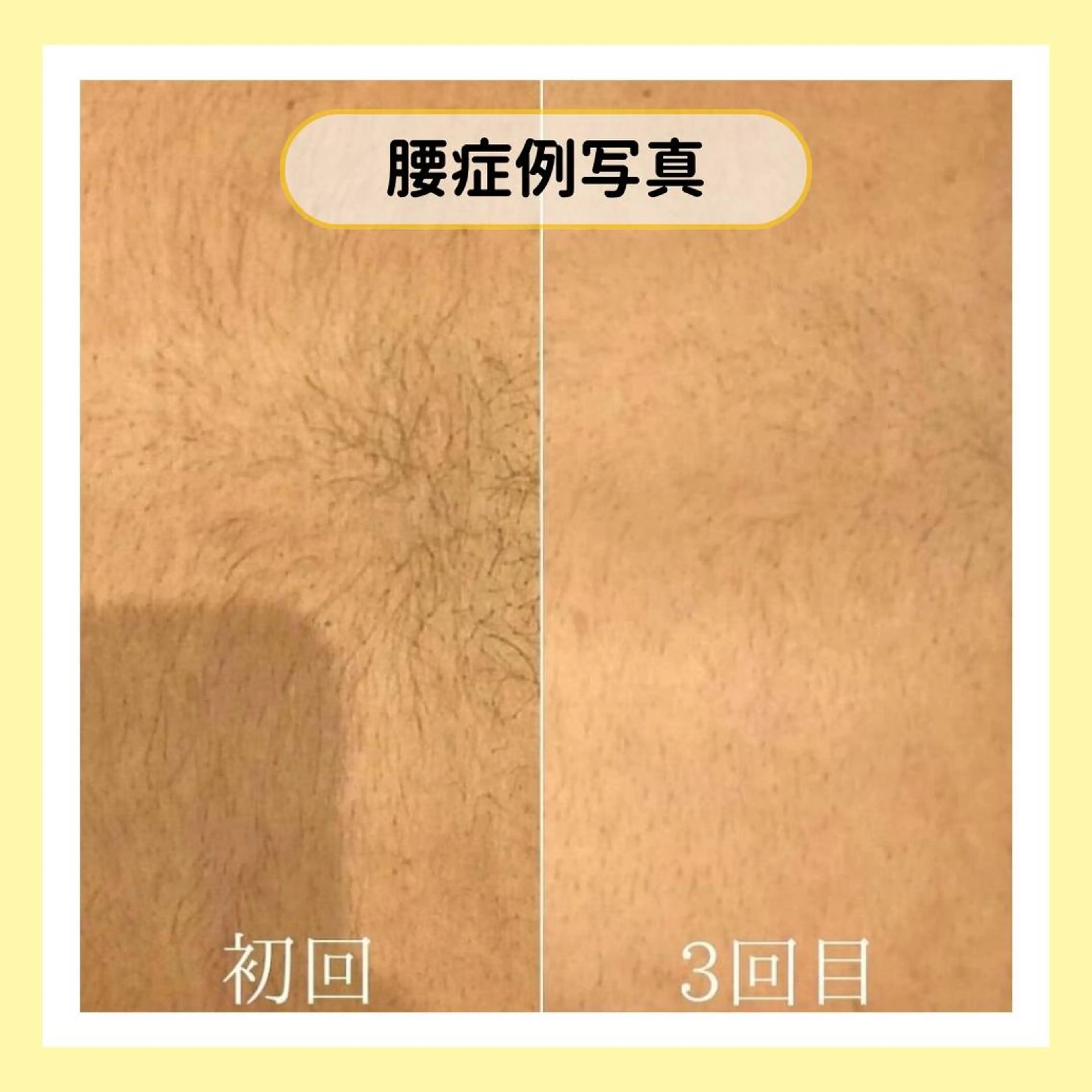 金山/脱毛/美肌 ULULUのエステ・リラクイメージ