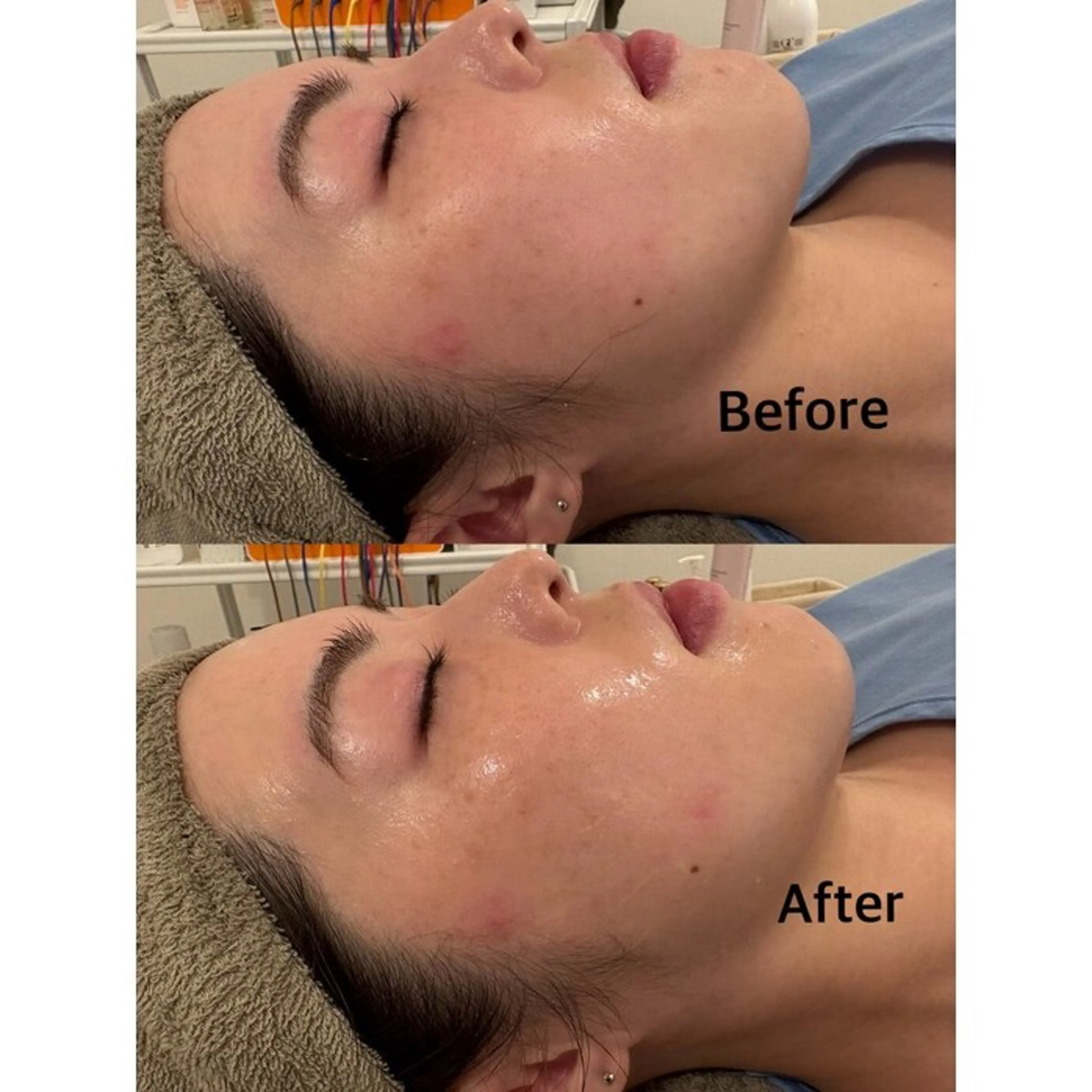 鍼灸サロン mahorobaトモのエステ・リラクイメージ