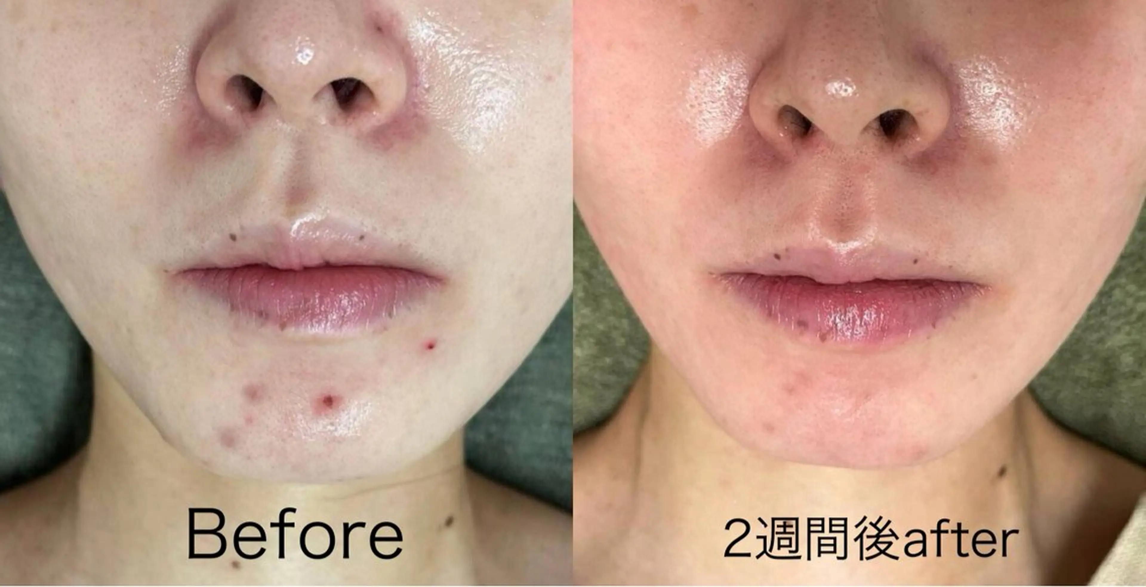 エステ salon de jessicaのエステ・リラクイメージ