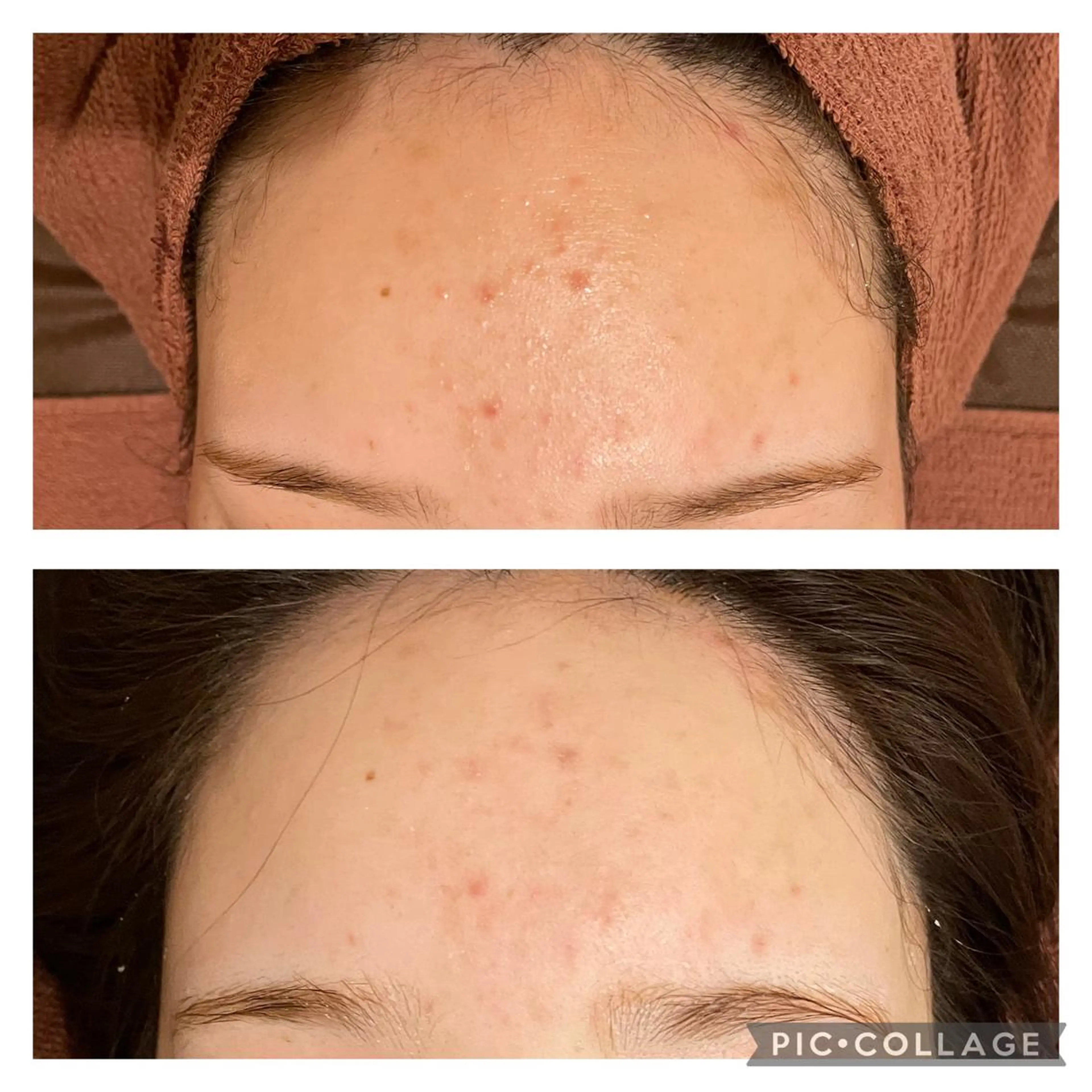 セミロング カラー パーマ ヘアアレンジ メンズ キッズ ネイル マツエク・マツパ アイブロウ エステ リラク ニキビ特化型エステ 🍋最短で肌質改善のエステ・リラクイメージ