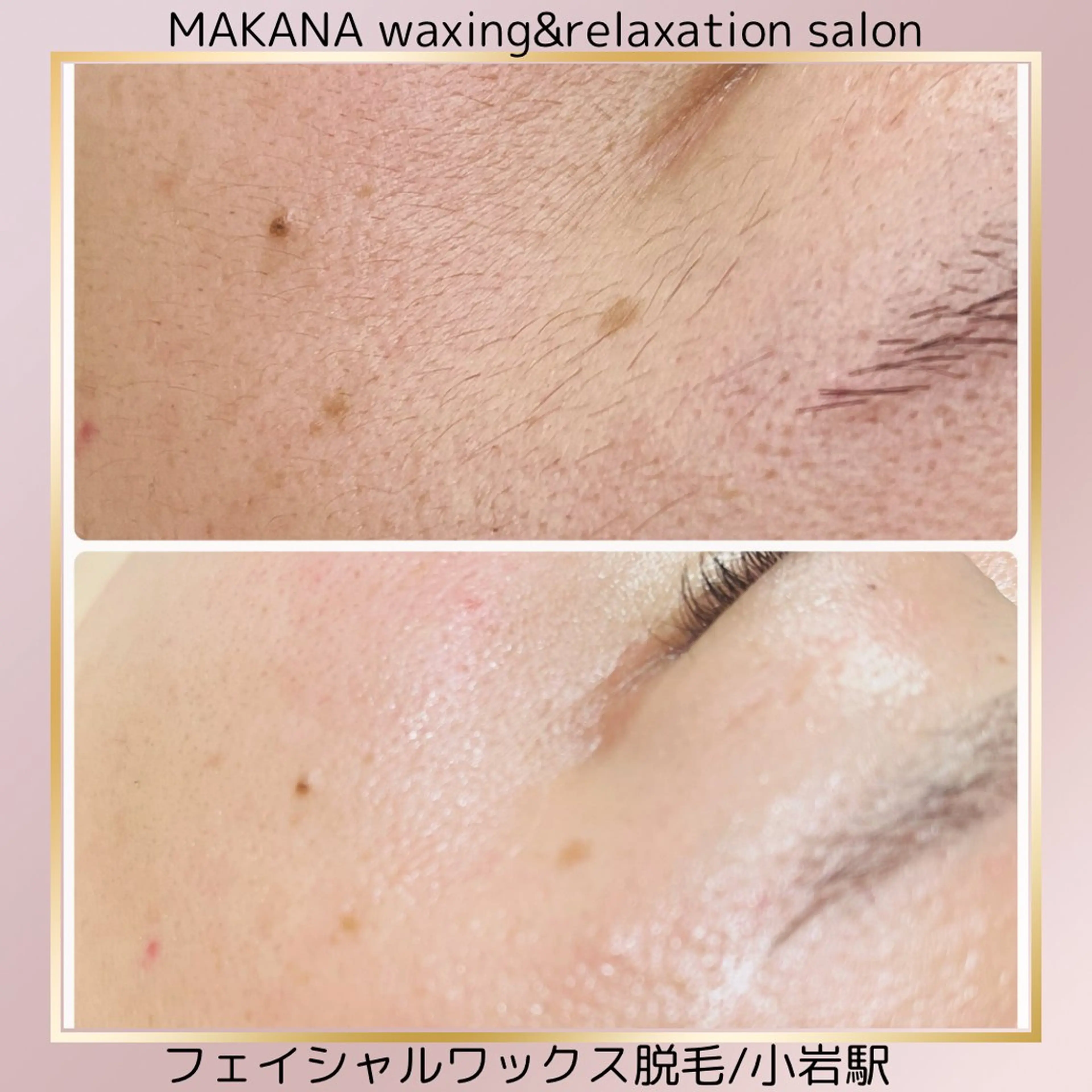 MAKANA waxing&relaxation所属・MAKANA 吉岡 小岩店のエステ・リラクイメージ