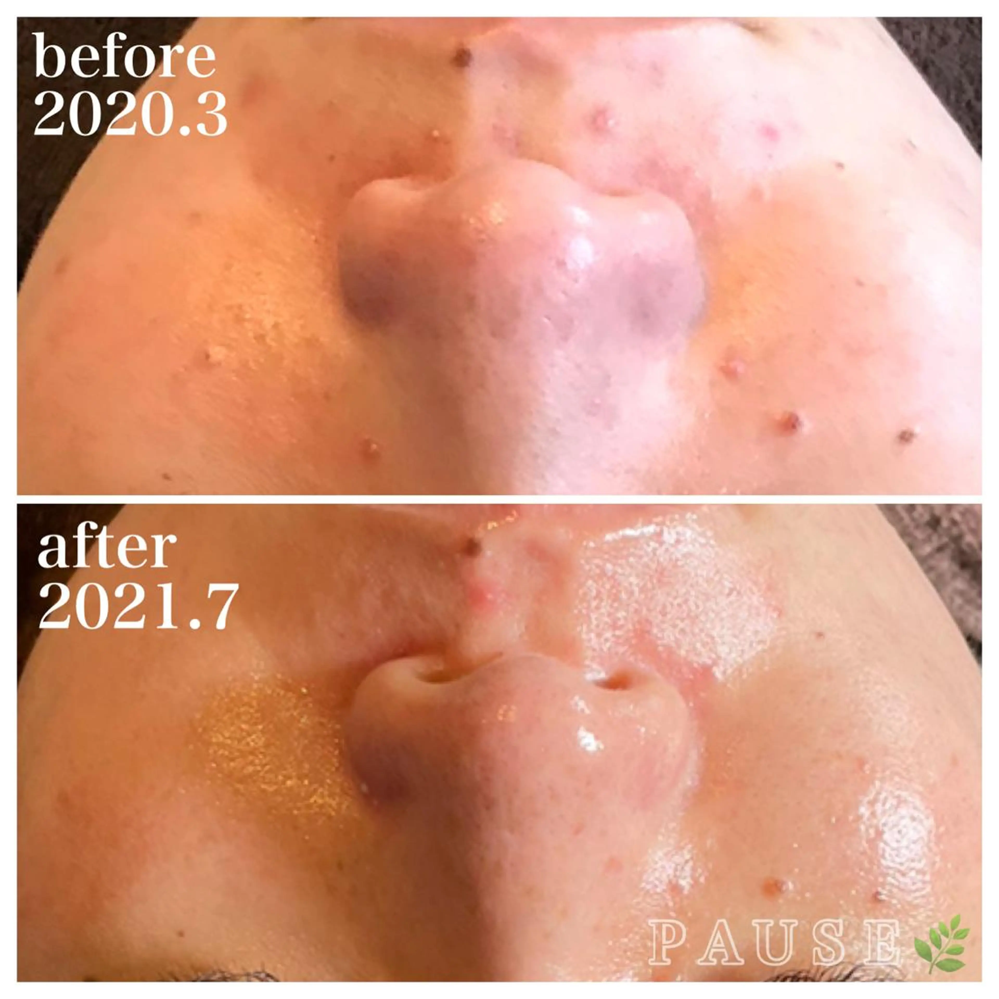 エステ 浜野 恵美のエステ・リラクイメージ