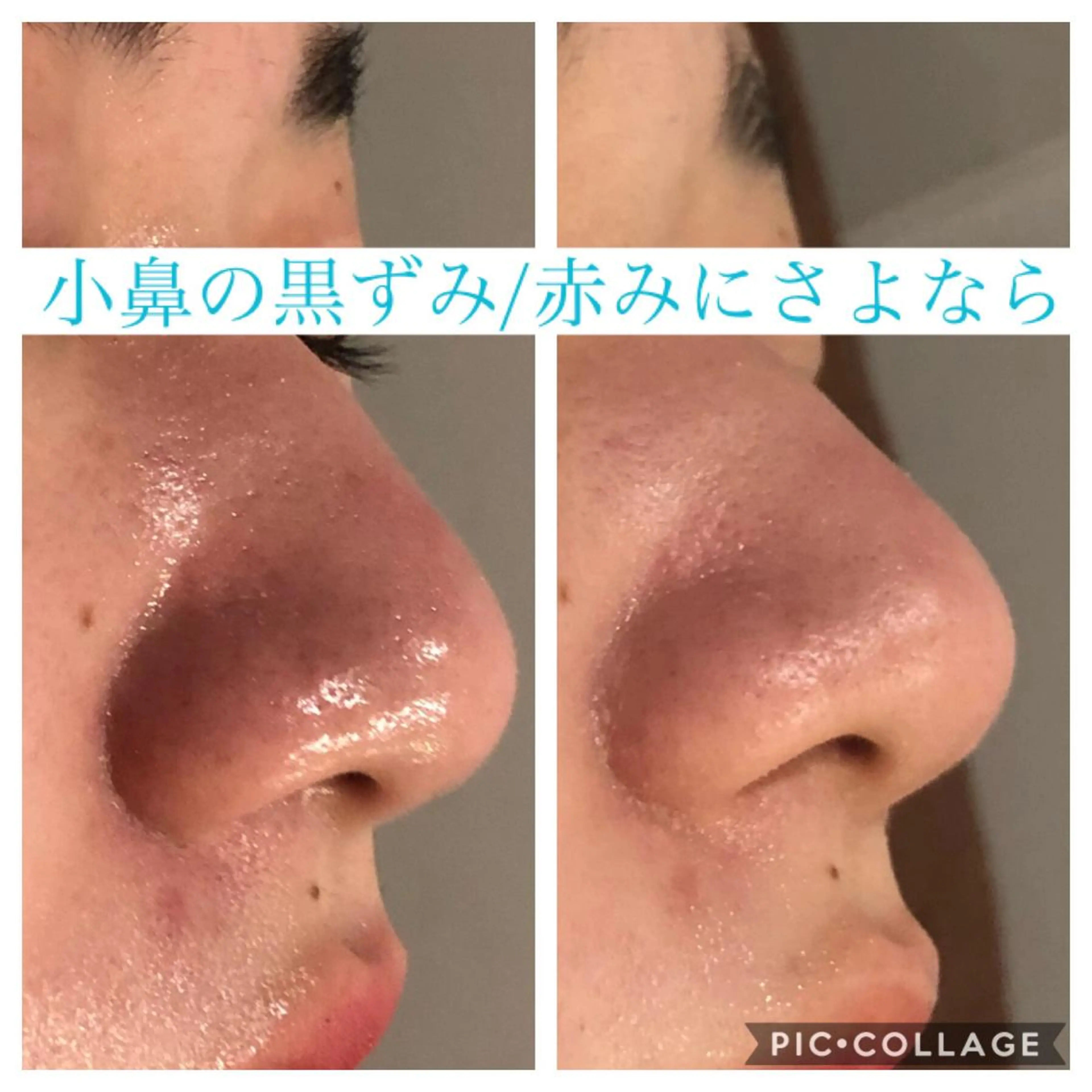 ロング カラー パーマ ヘアアレンジ キッズ ネイル マツエク・マツパ エステ リラク EnsorClair 代表　野口真央のエステ・リラクイメージ