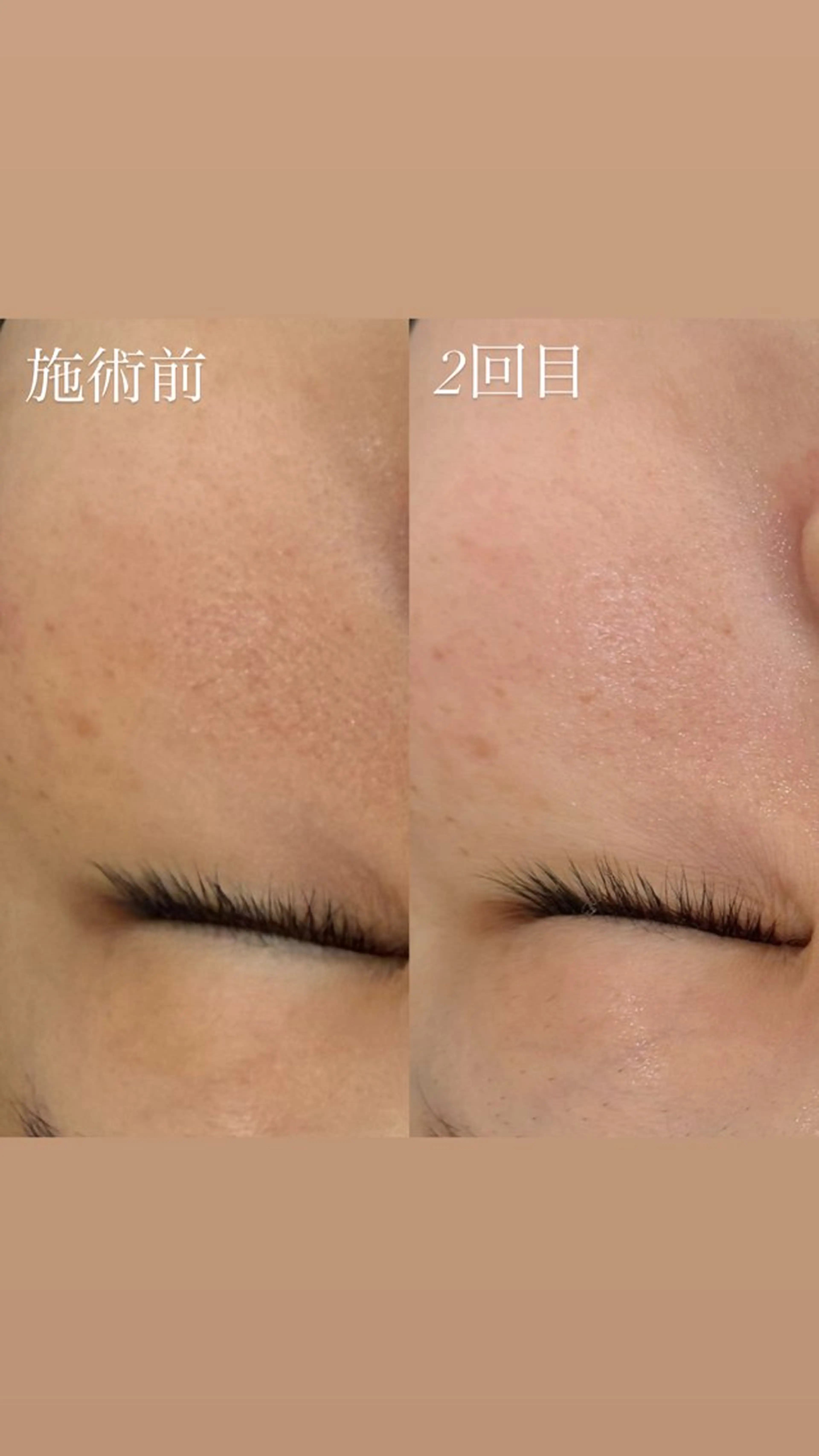 艶肌デトックス🫧 Samiraのエステ・リラクイメージ