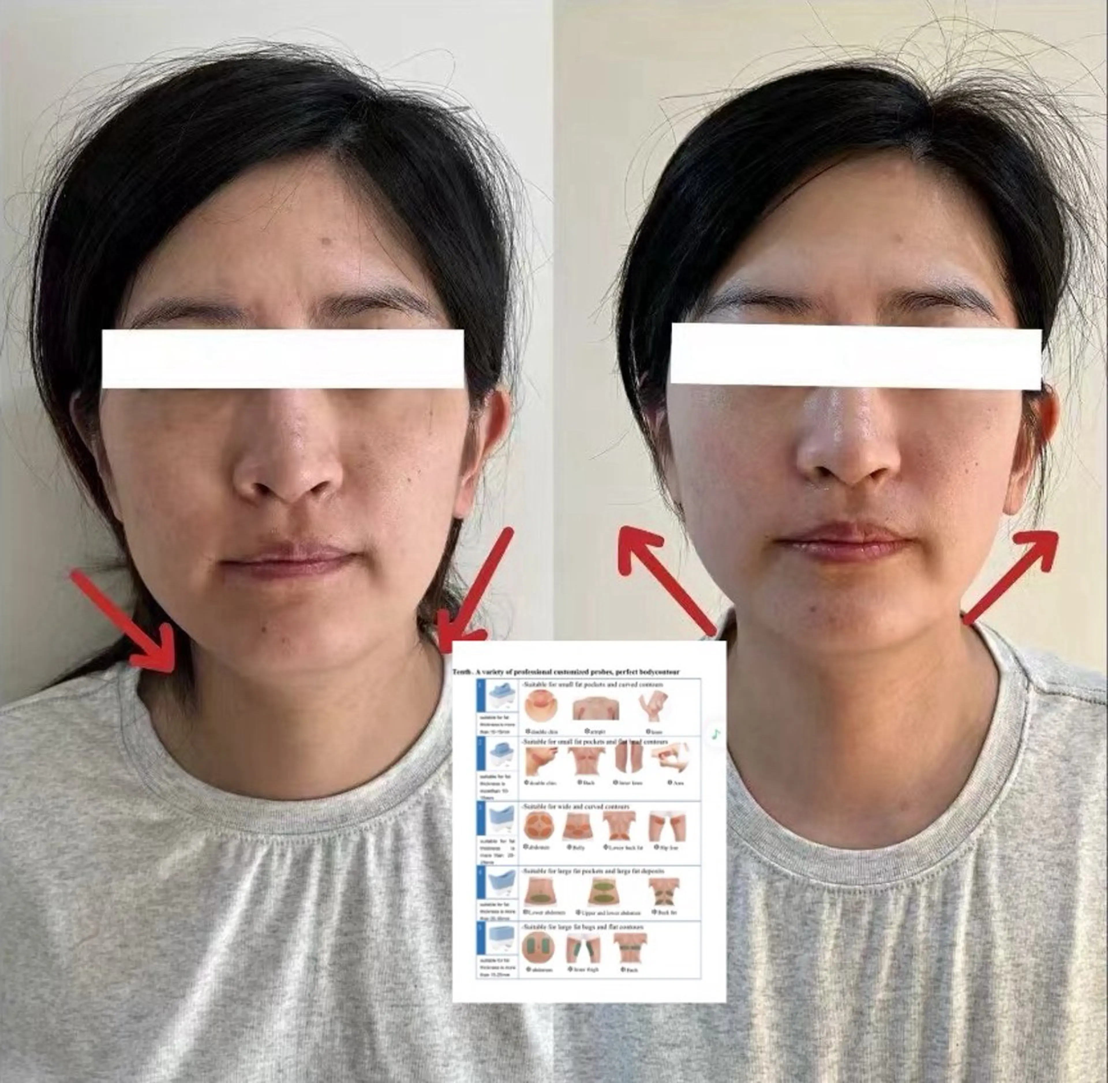 ショート aliaハーブ水光店 エステティシャン募集のエステ・リラクイメージ