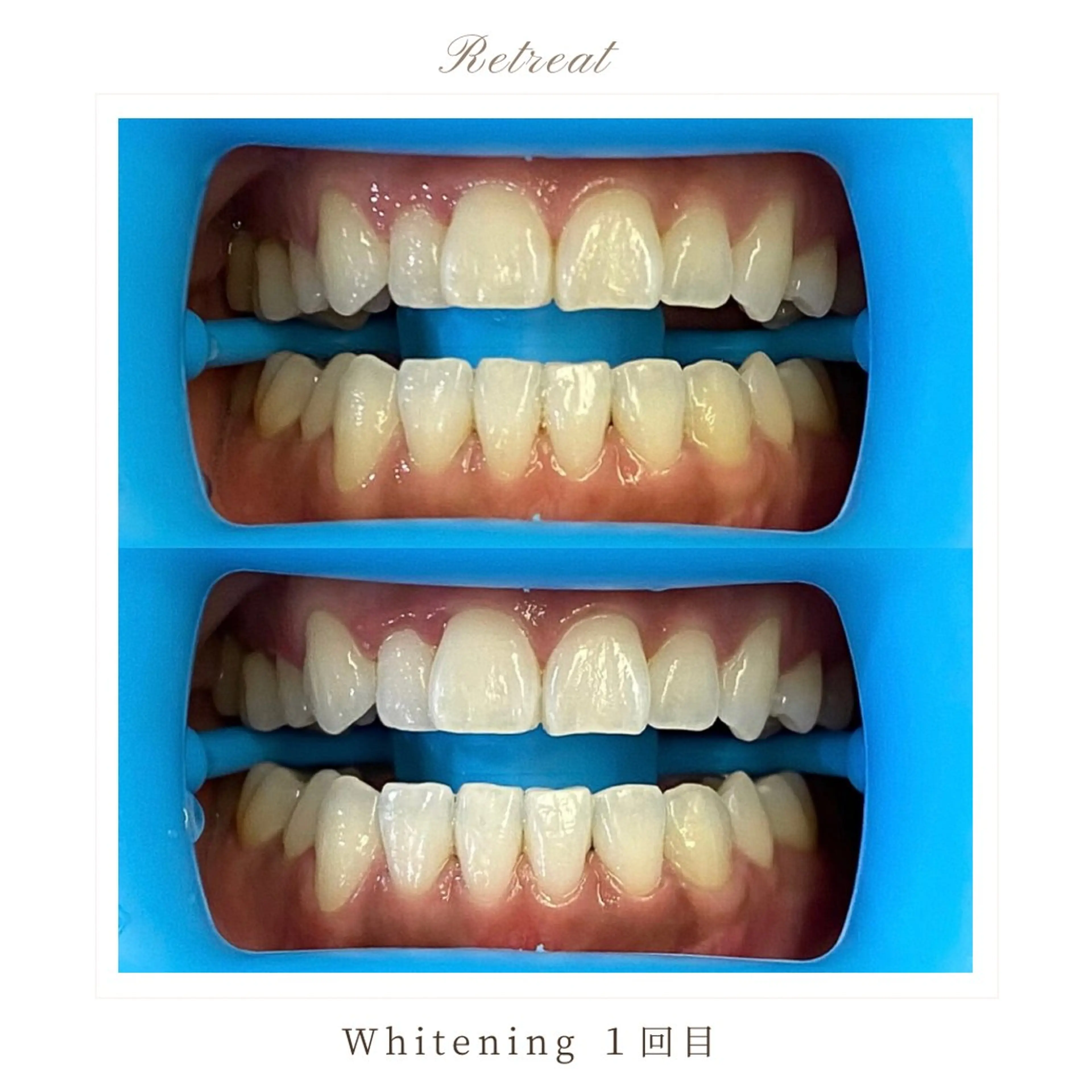 Retreatリトリート所属・歯科医院提携 Retreatのエステ・リラクイメージ