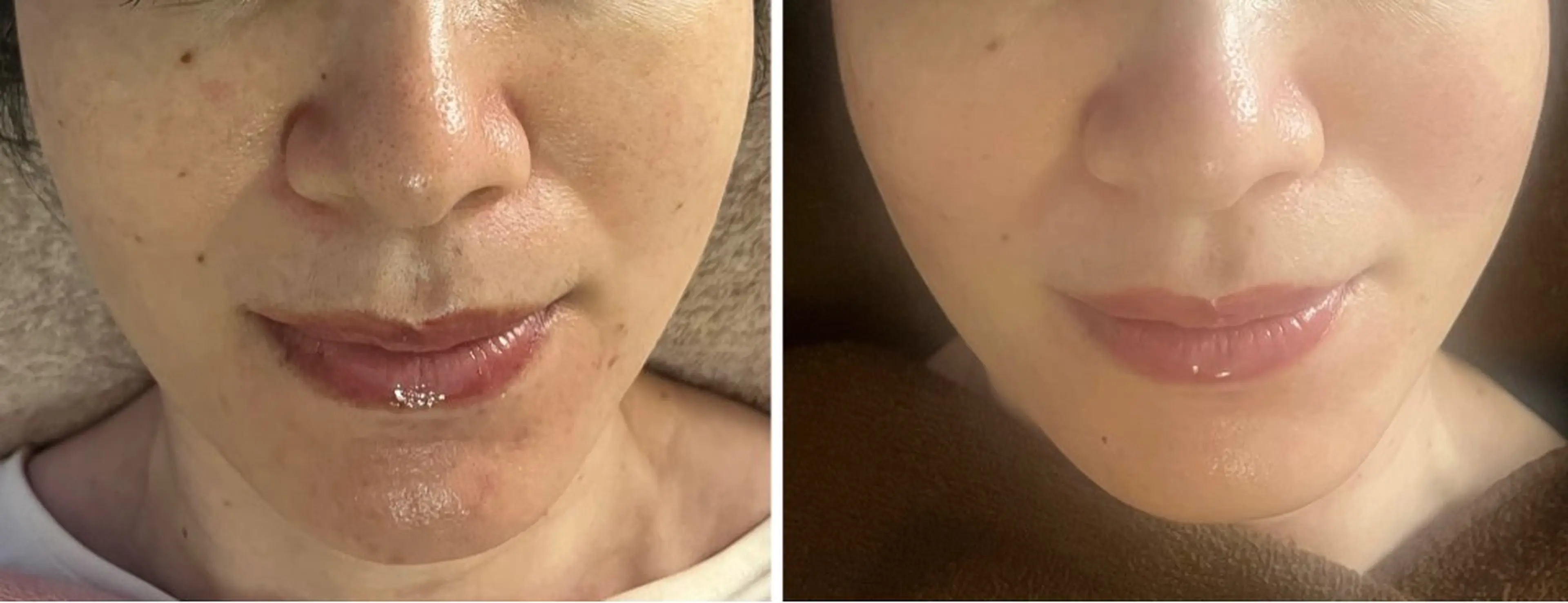 アロマ･美容鍼･カッ ピング「麗」鍼灸院のエステ・リラクイメージ