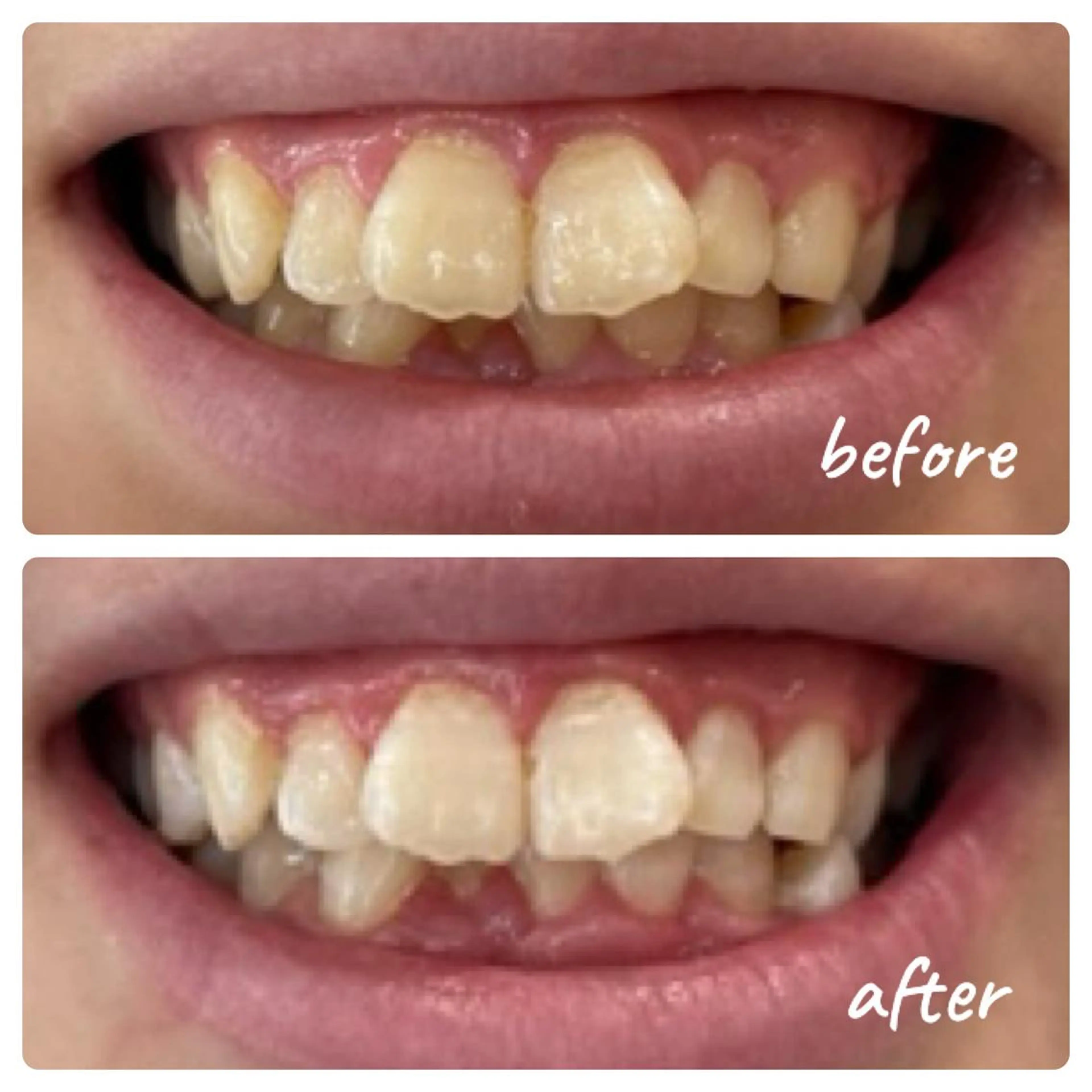 noel de mi 前川亜里沙のエステ・リラクイメージ