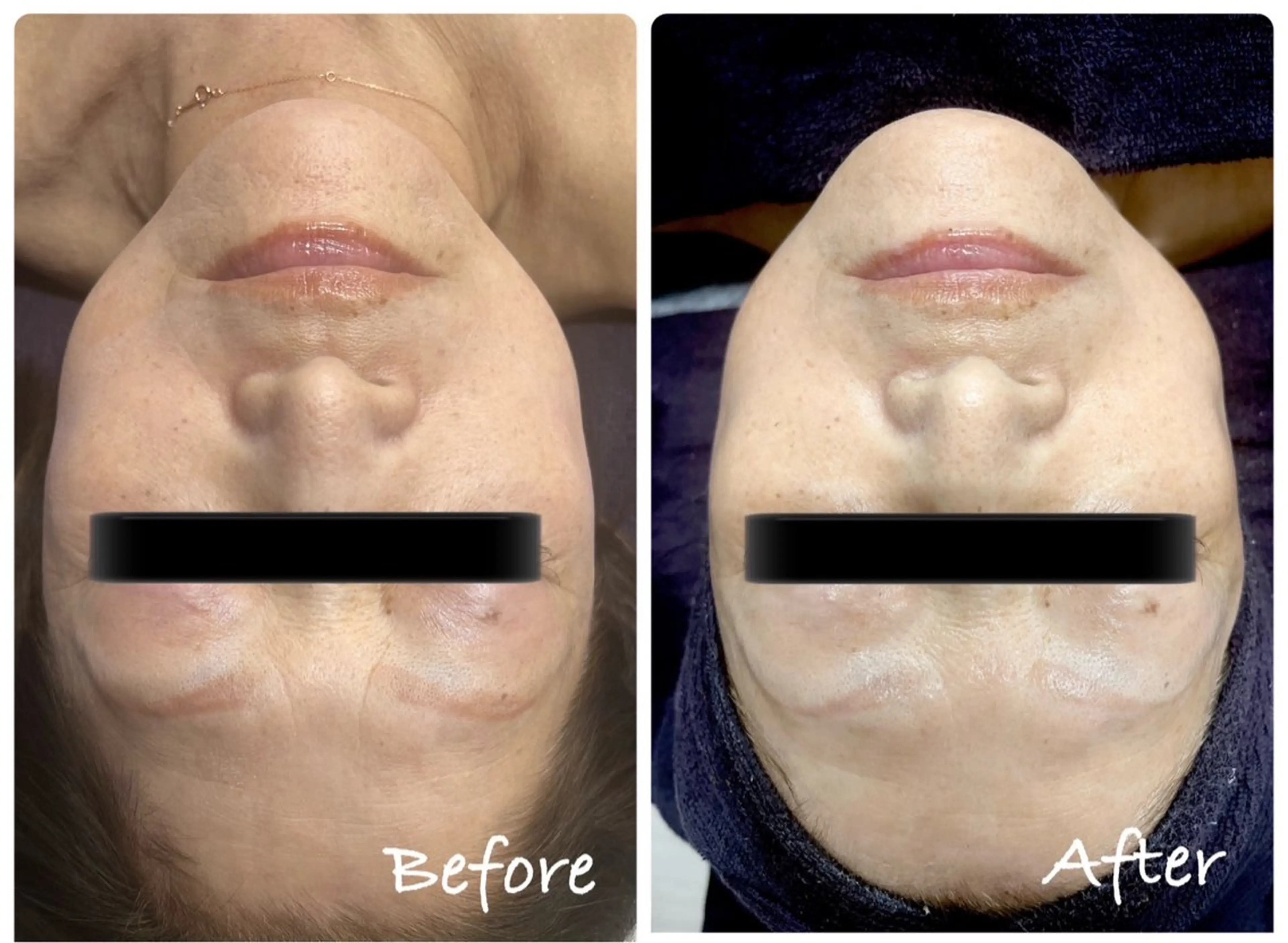 エステ Genesis Plus大津京店のネイルデザイン