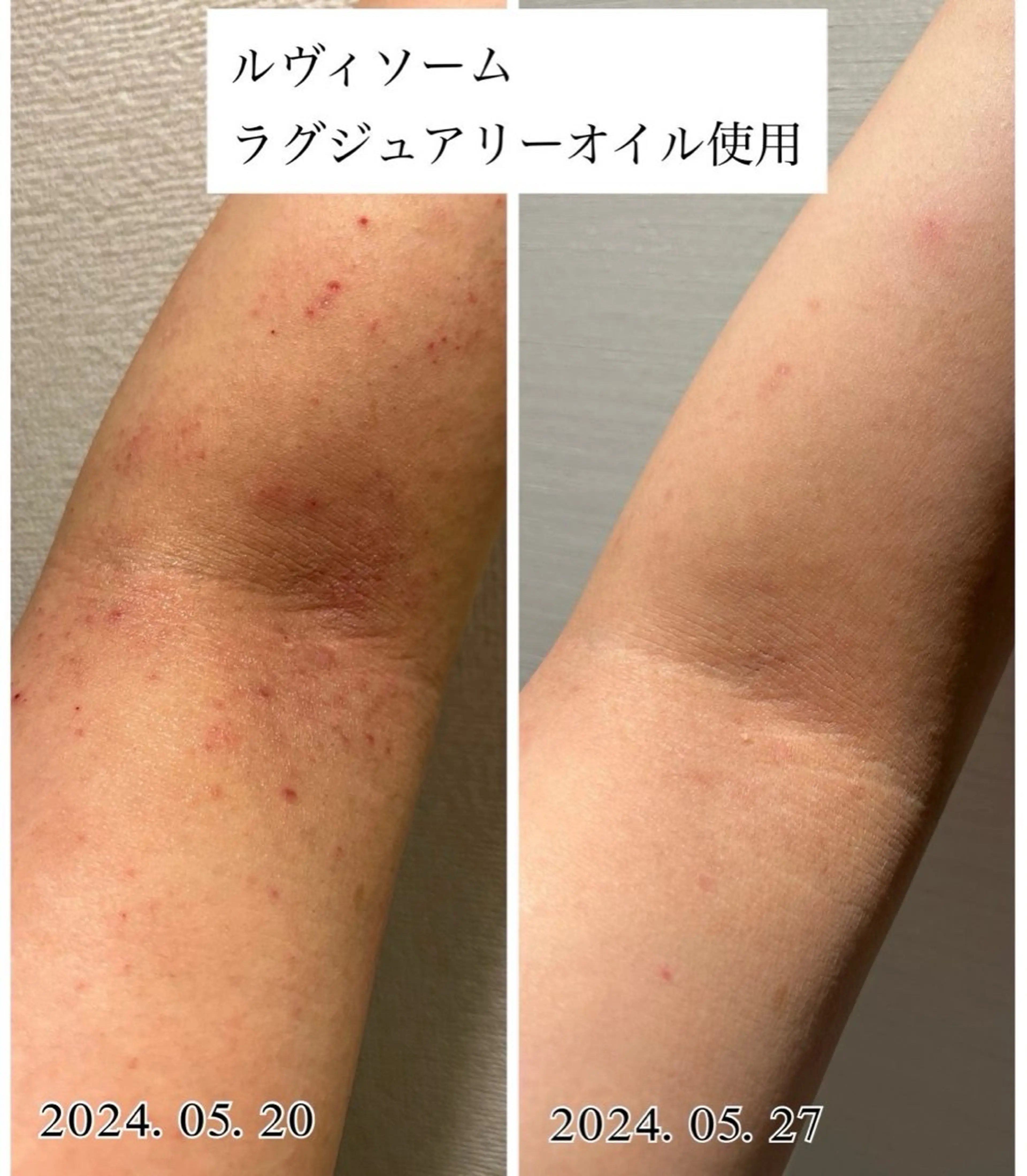 肌管理専門店 mebell天王寺店のエステ・リラクイメージ