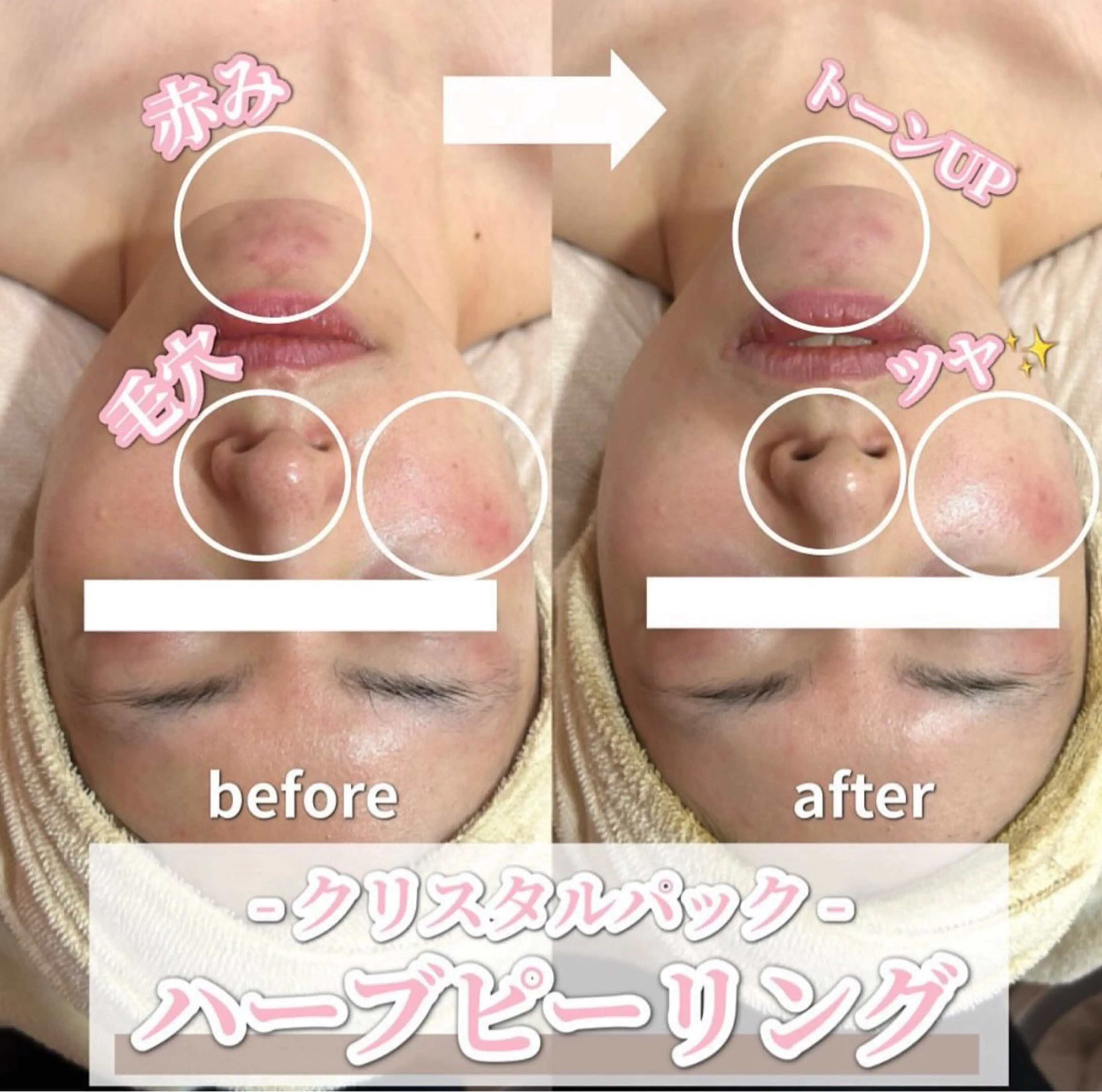 エステ SALON韓国肌管理 東別院のエステ・リラクイメージ