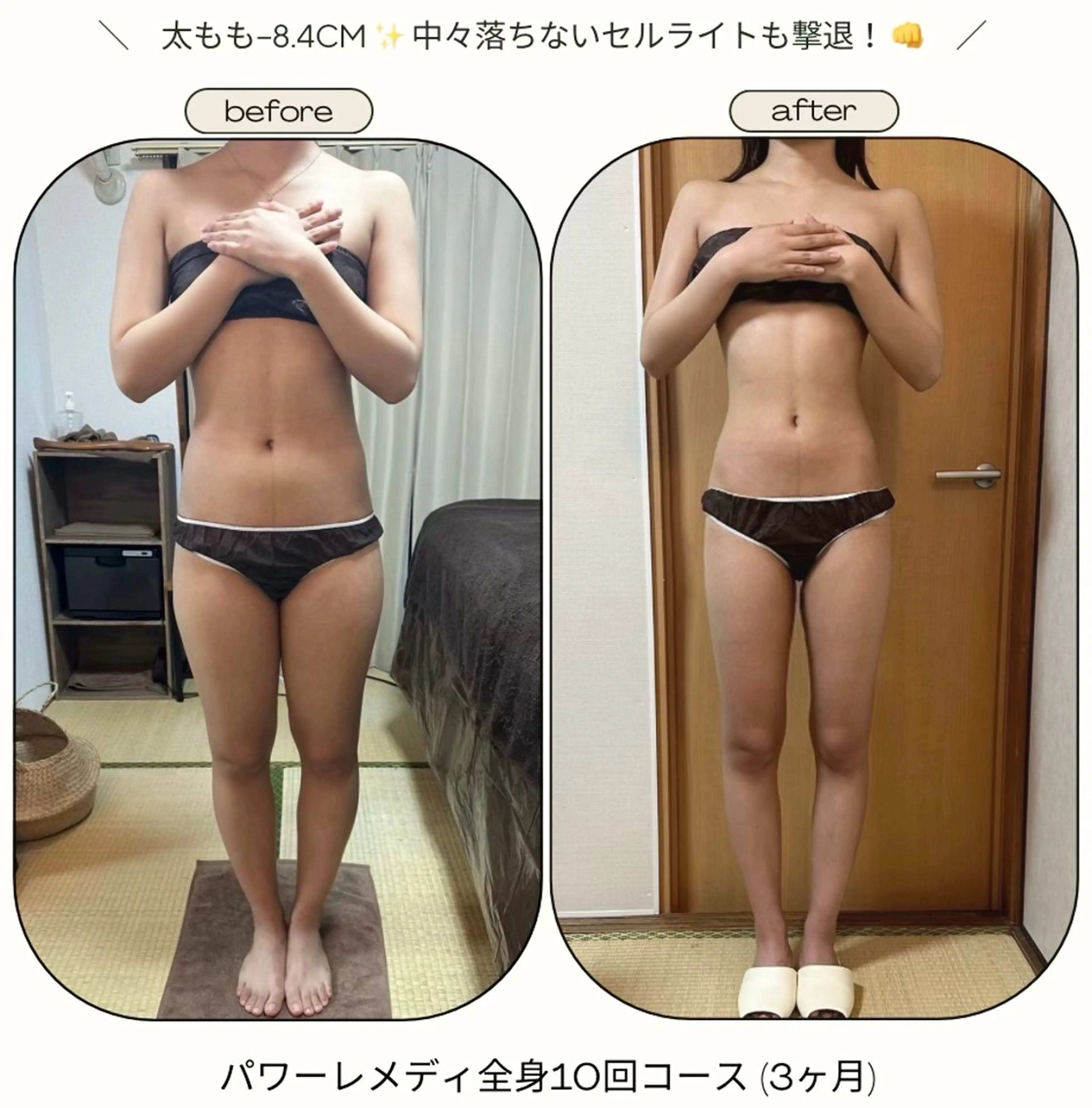 《本気痩せ×疲労改善 》  BILOOPのエステ・リラクイメージ