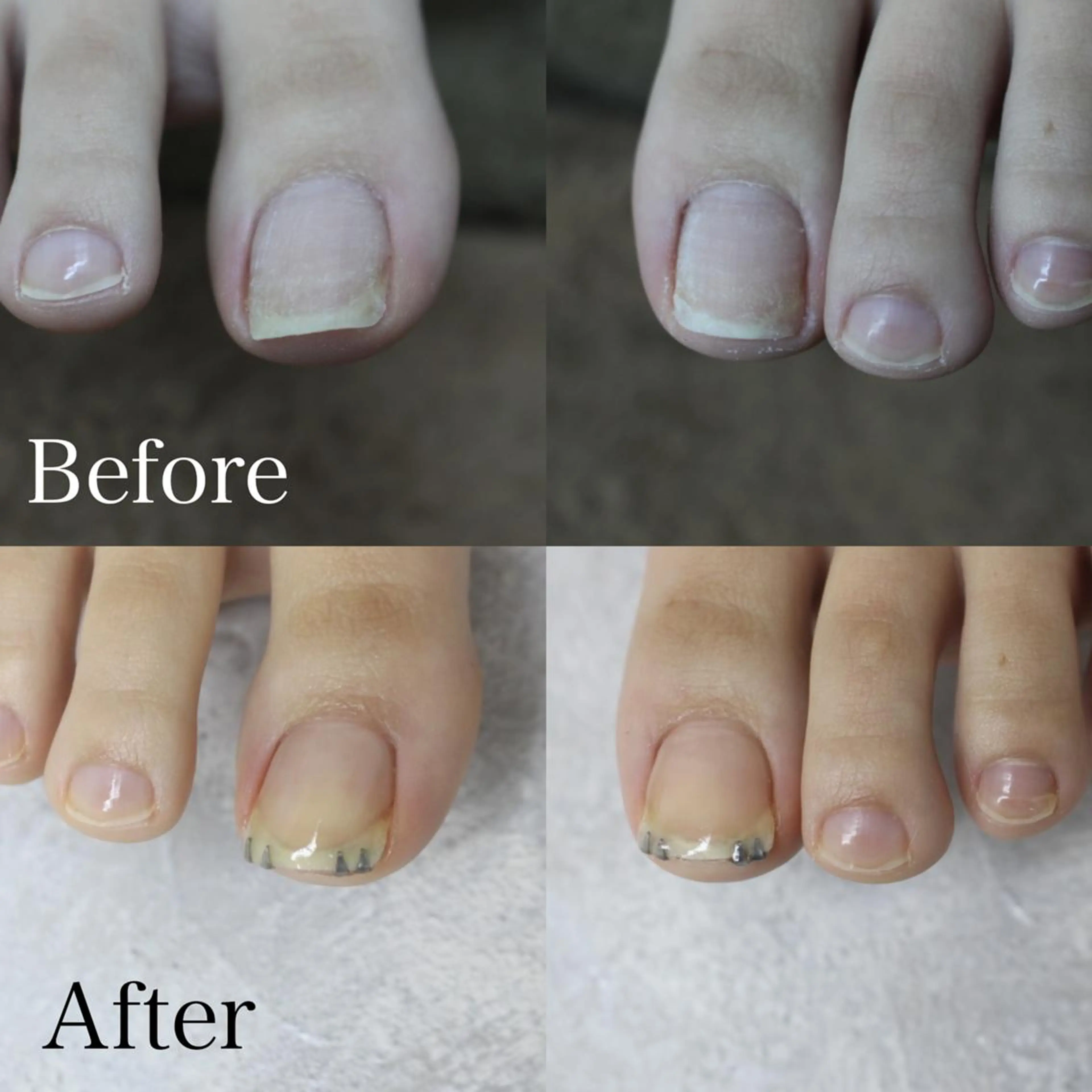 東 あきらのネイルデザイン