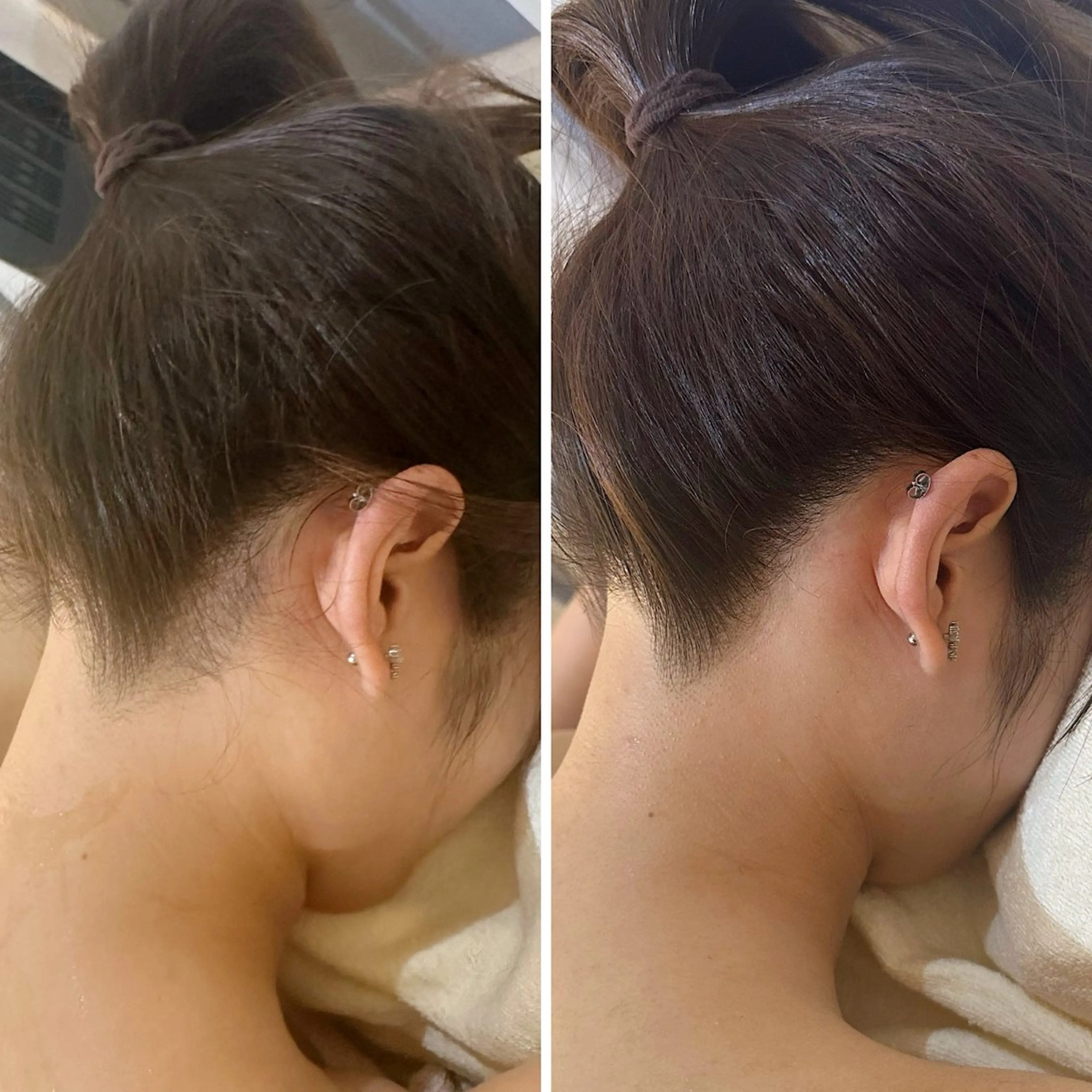 脱毛 うなじ脱毛/美肌脱毛 LABELのエステ・リラクイメージ