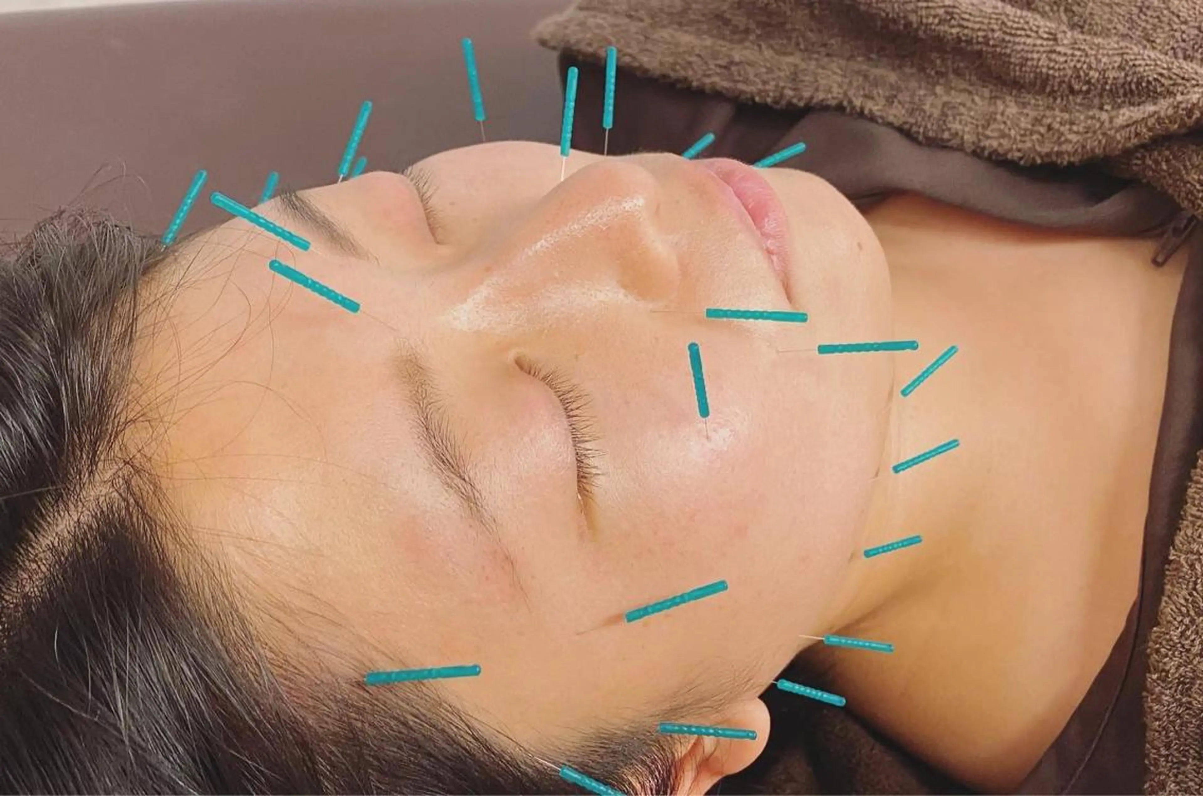 アオイ 【IGO】のエステ・リラクイメージ