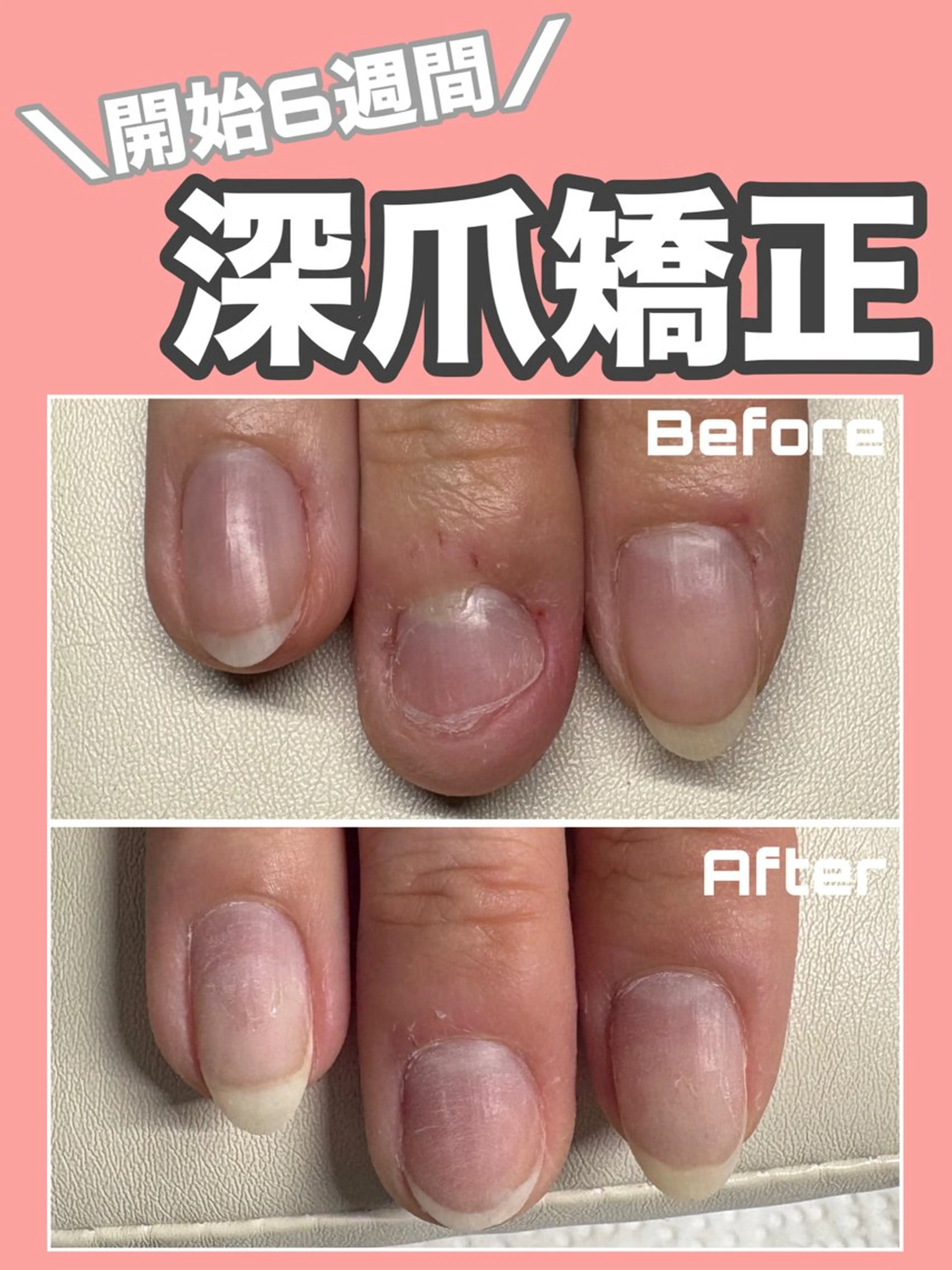 ネイル 長さ出し ジェルネイル ハンドネイル ハンドケア nail salon petillantのネイルデザイン