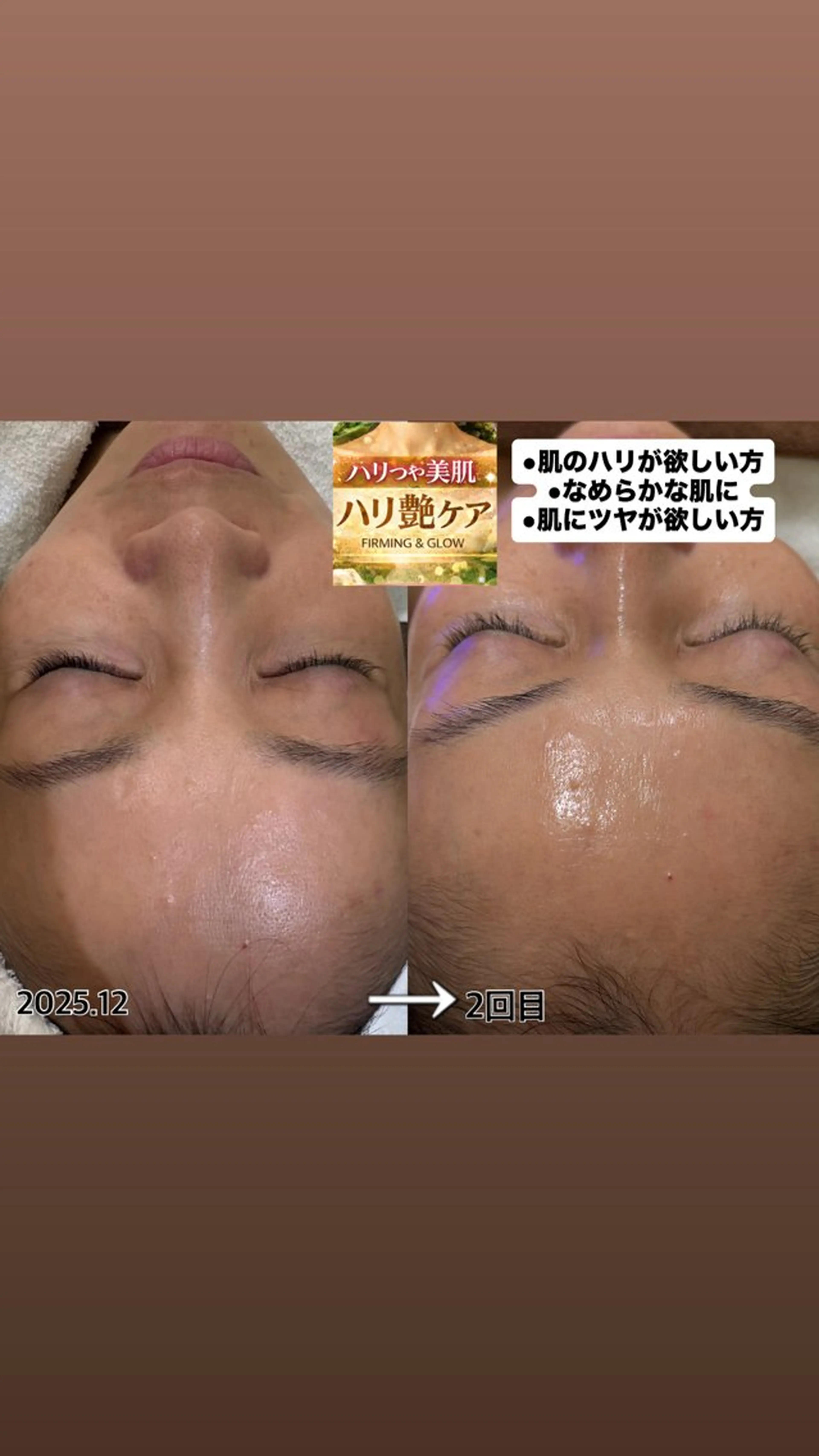 韓国艶美人// 毛穴ケア🌹のエステ・リラクイメージ