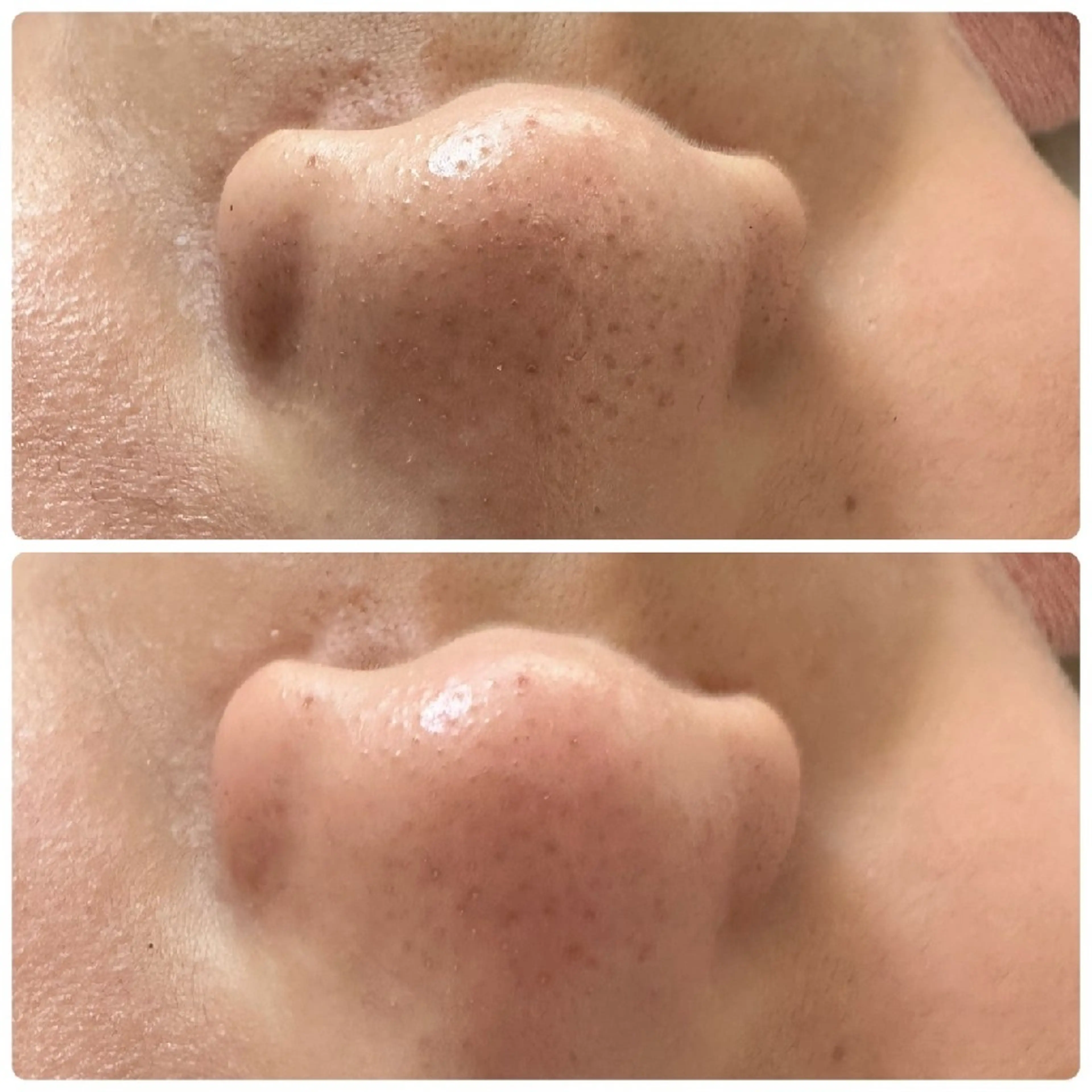 Prima（プリマ） 名古屋駅本店のエステ・リラクイメージ