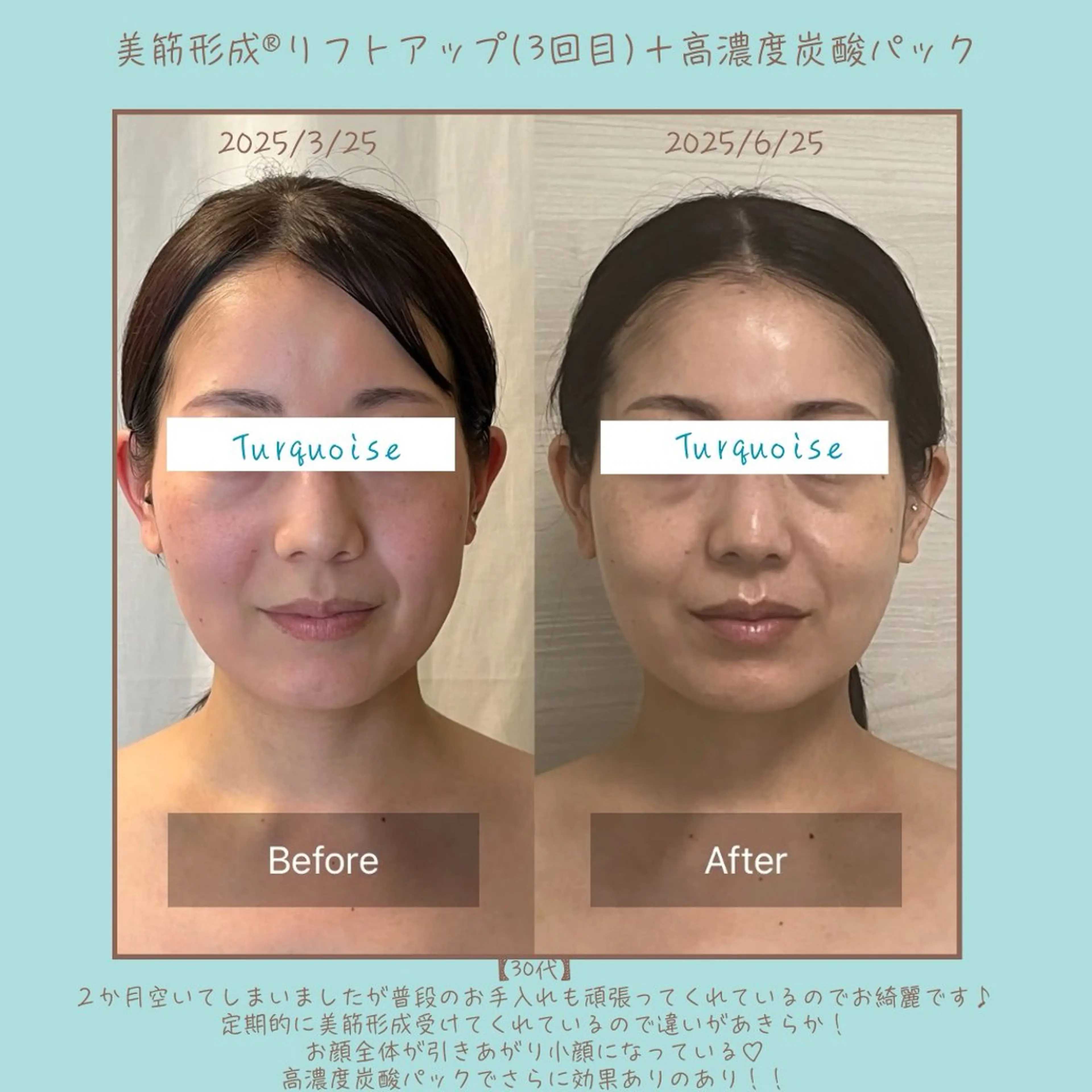 フェイシャルエステ Turquoiseのエステ・リラクイメージ