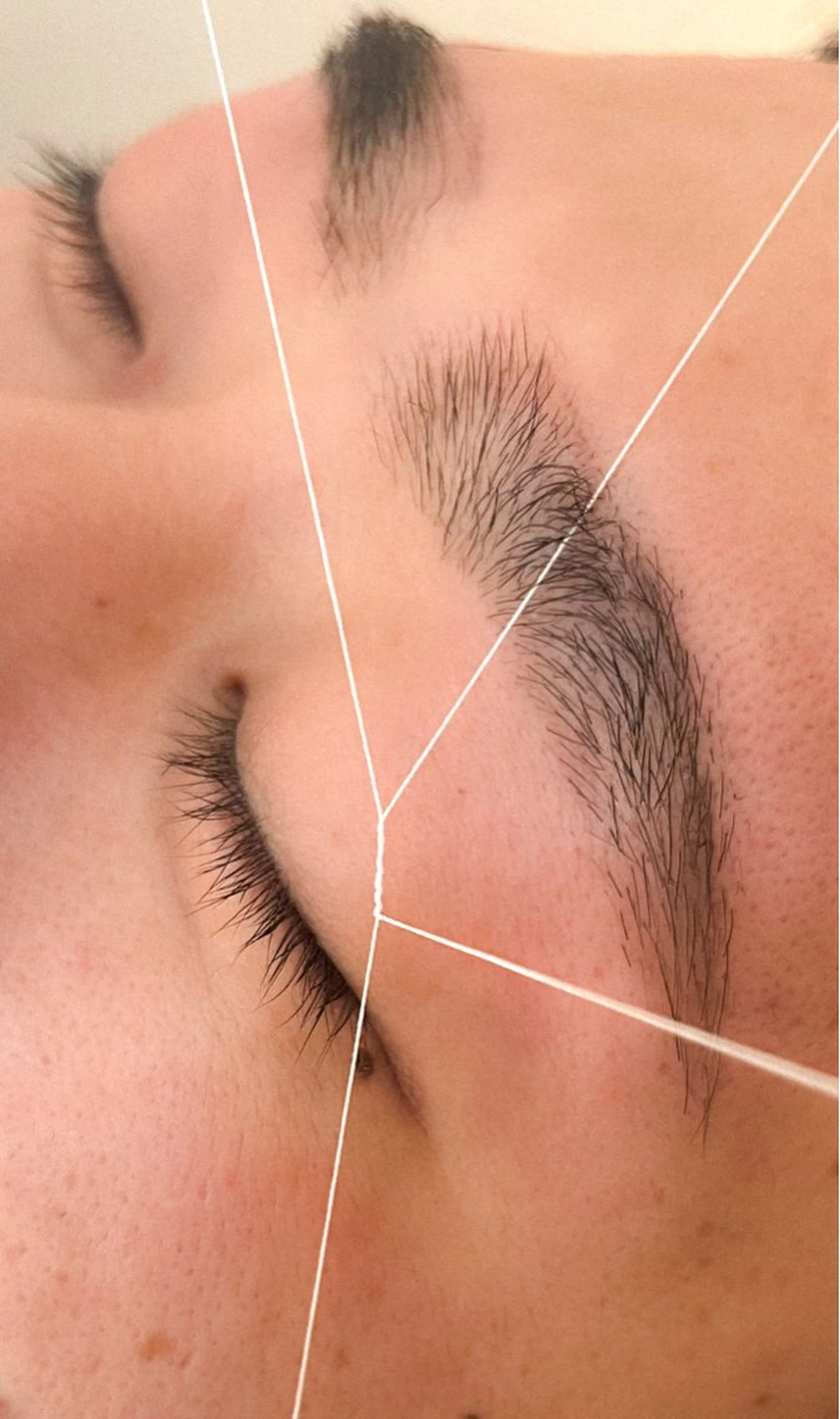 スレッディング脱毛の写真