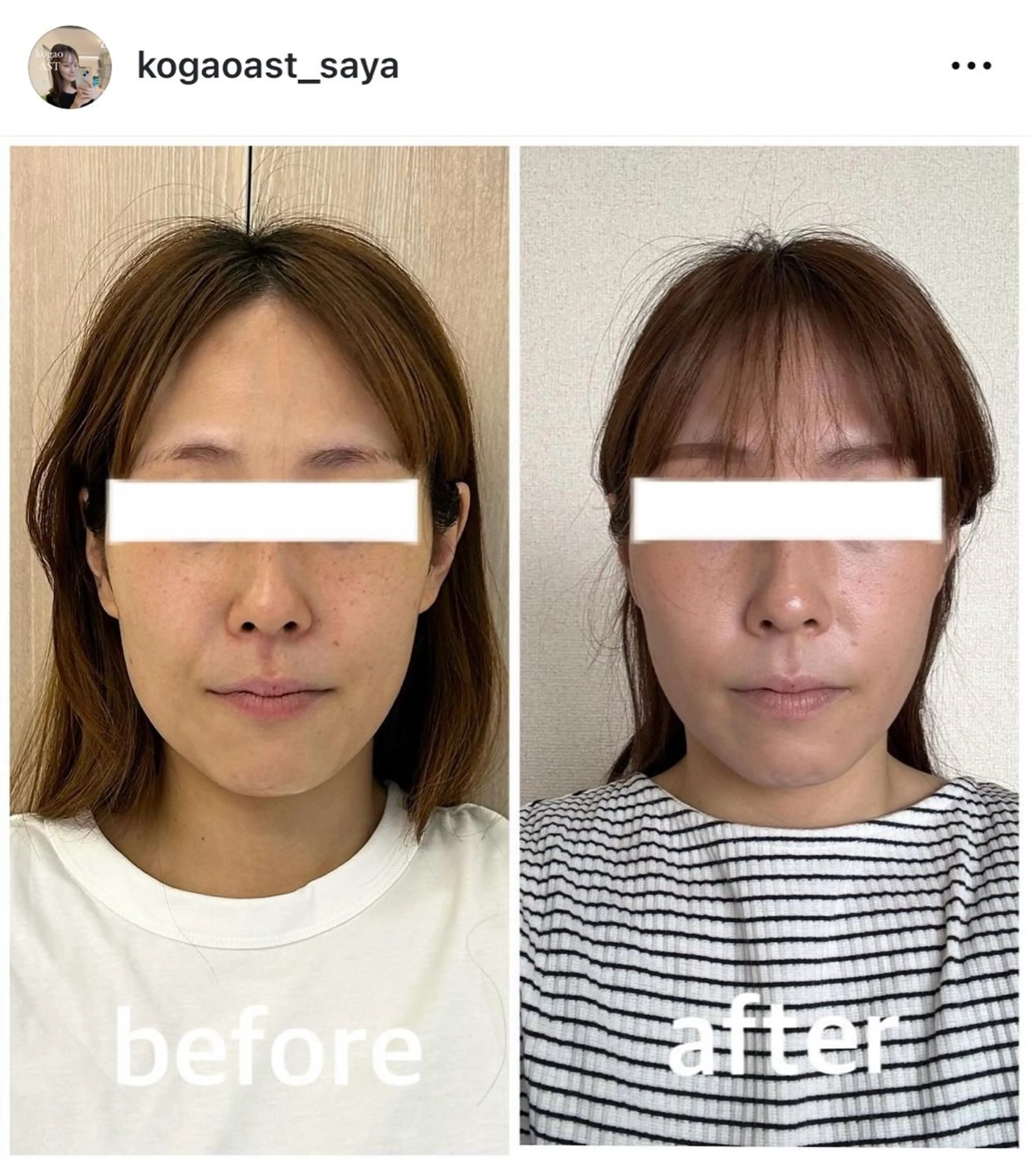 その他 小顔矯正サロンAST【アスト】所属・小顔矯正サロン AST【アスト】のその他イメージ