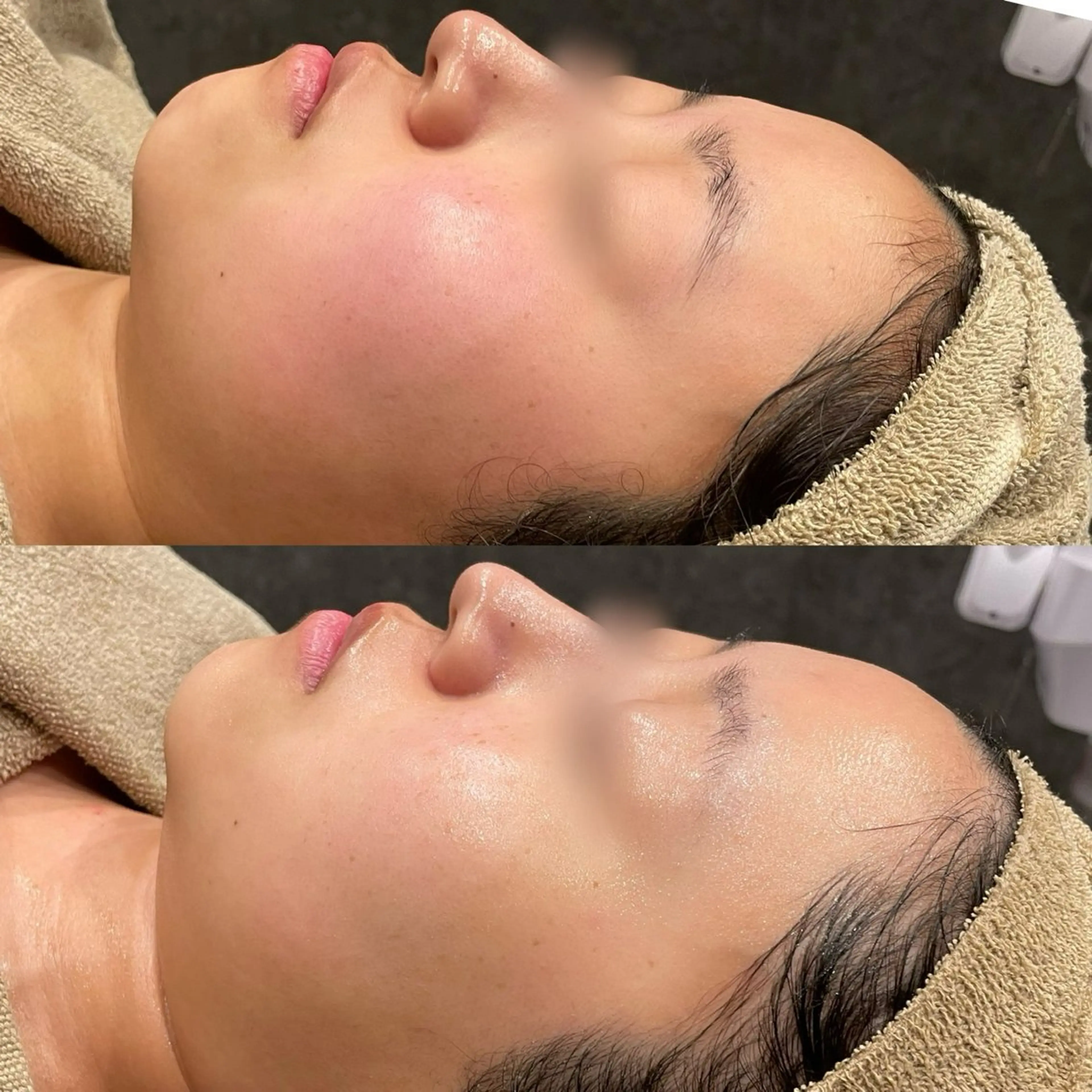 エステ Re:Belle 久留米 : 中島のエステ・リラクイメージ