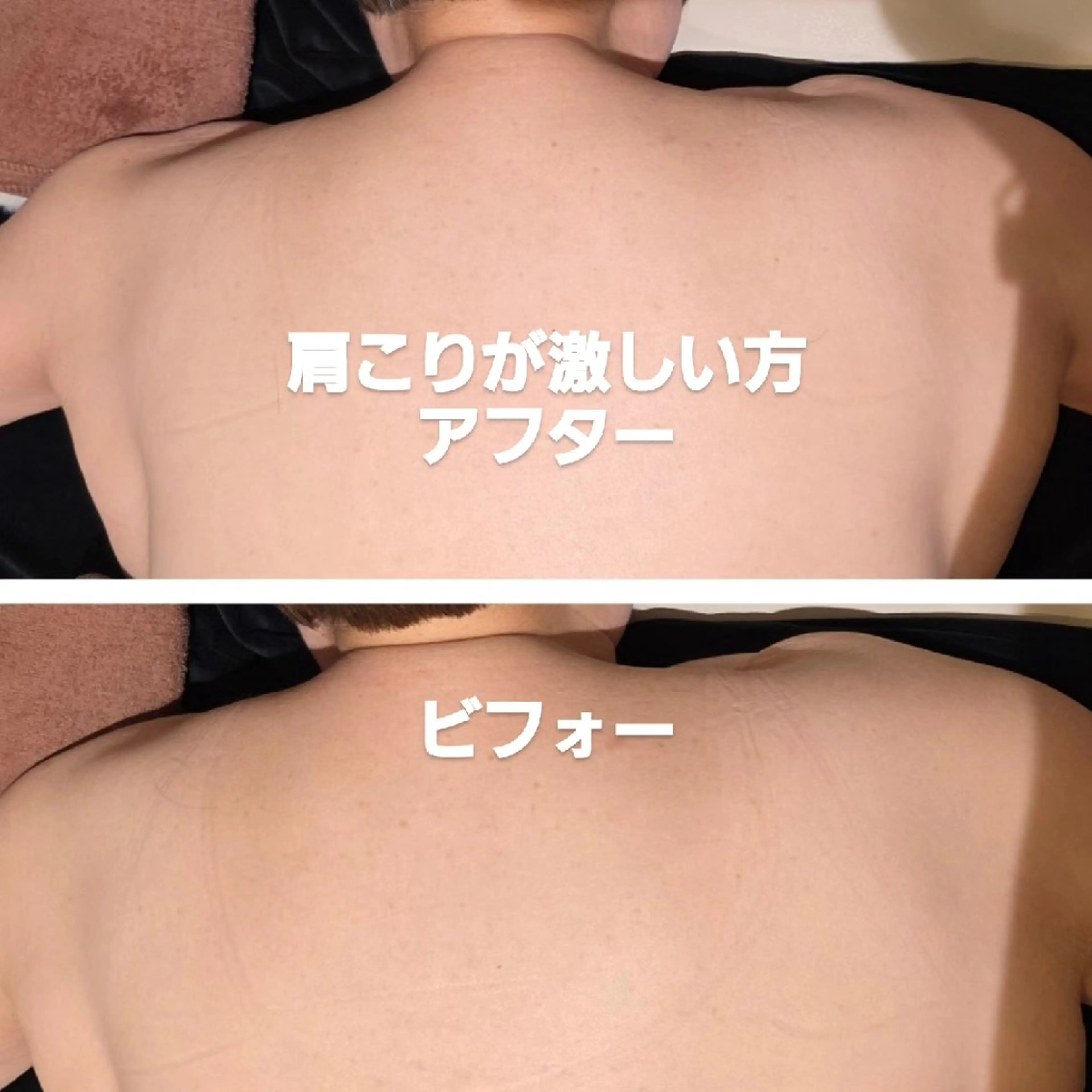 肩こりにキャビテーションの写真