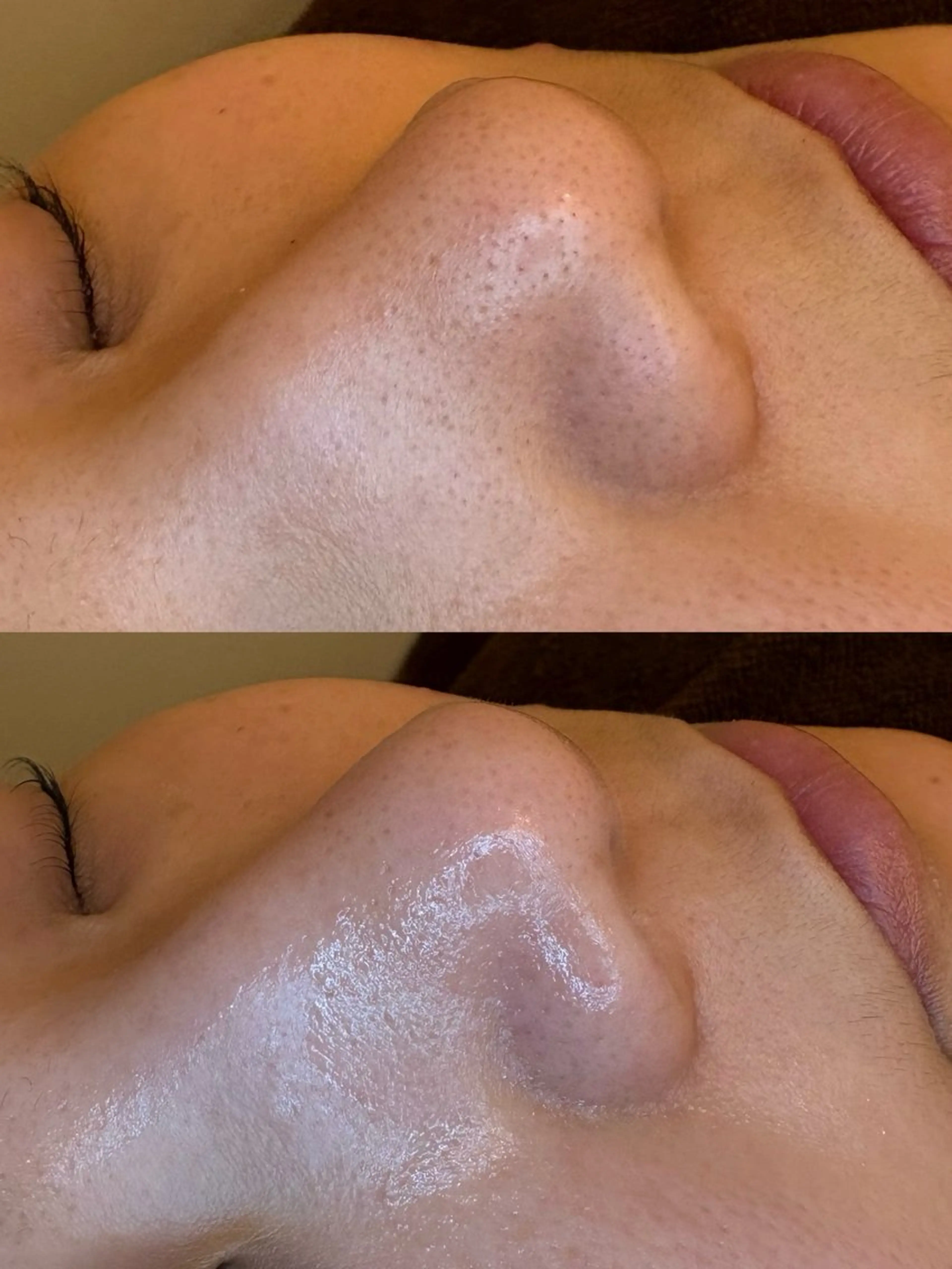 🤍アベシュリ /フェイシャル🤍のエステ・リラクイメージ