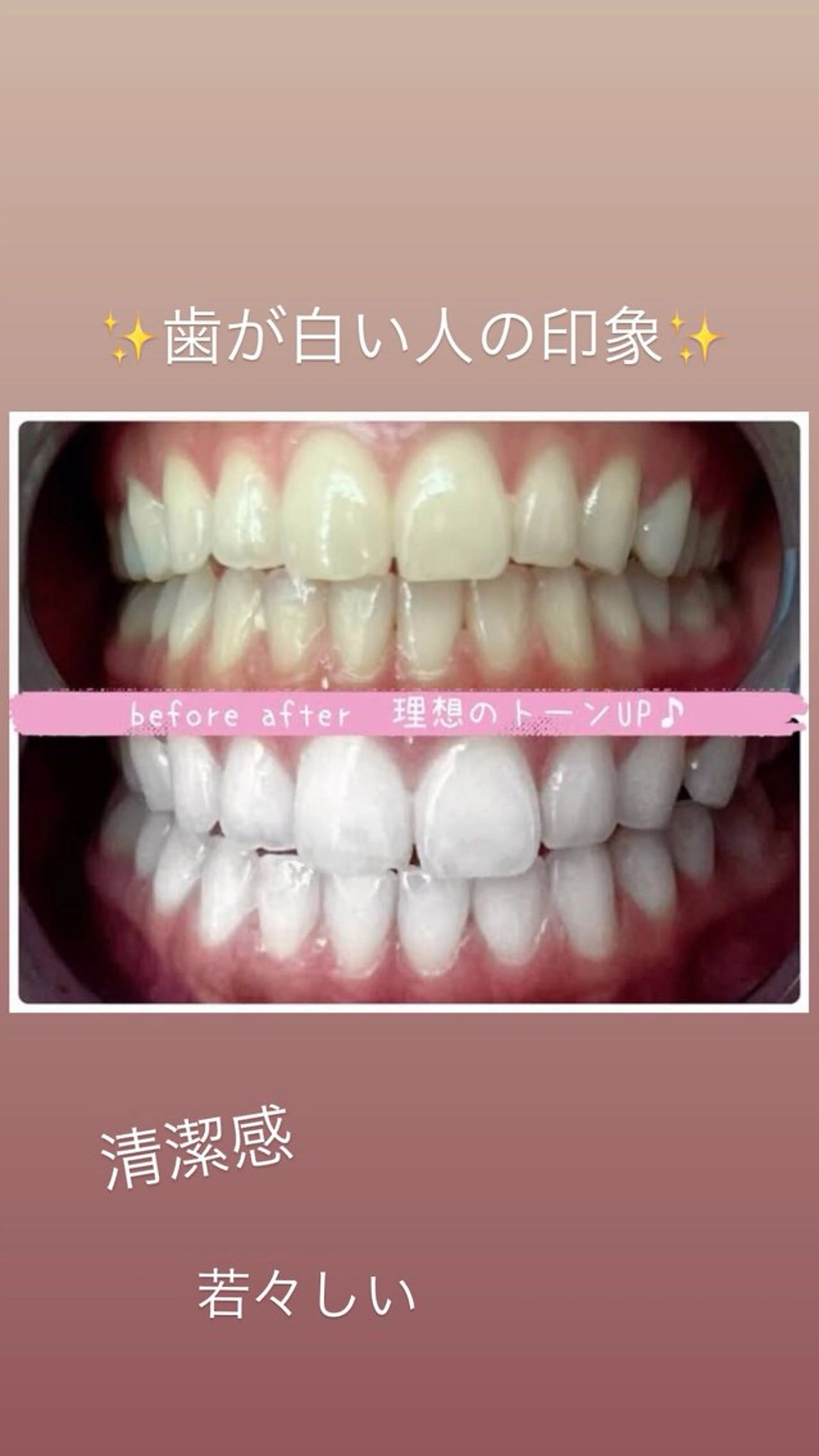 エクシア ホワイトニング西条店のその他イメージ