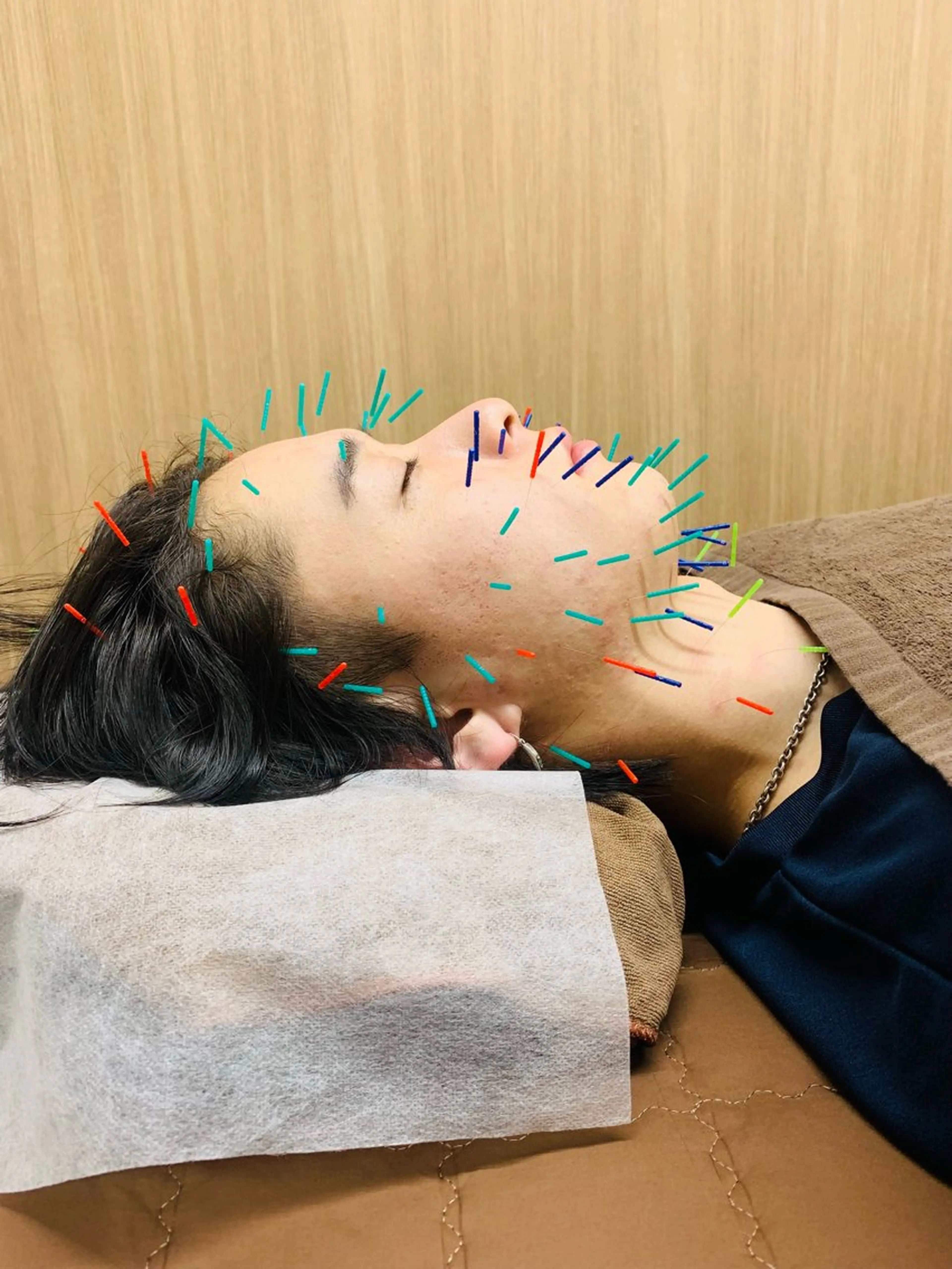 NO.10 整骨院のエステ・リラクイメージ