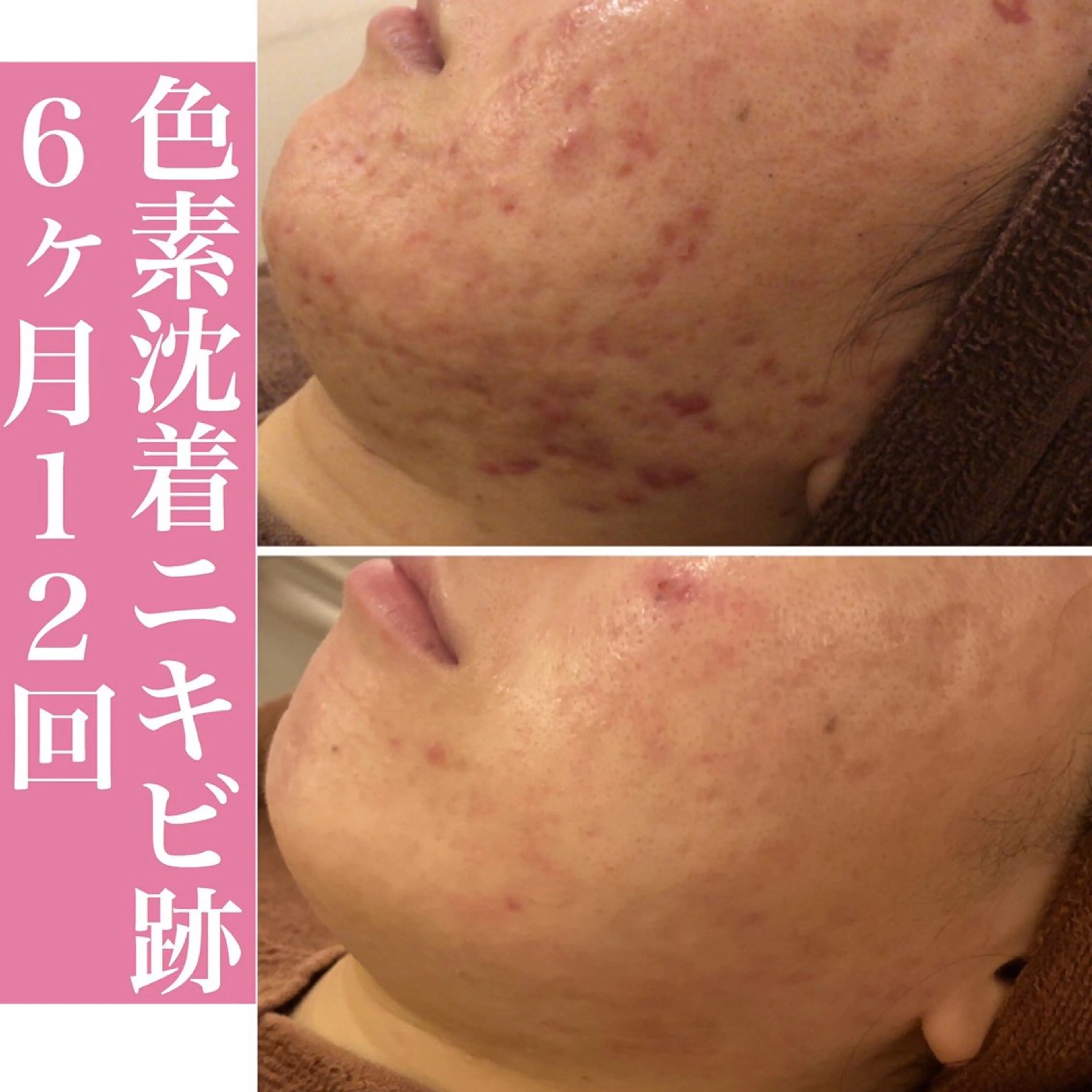 エステ リラク ニキビ・肌質改善専門 ♡人生が変わるサロンのエステ・リラクイメージ