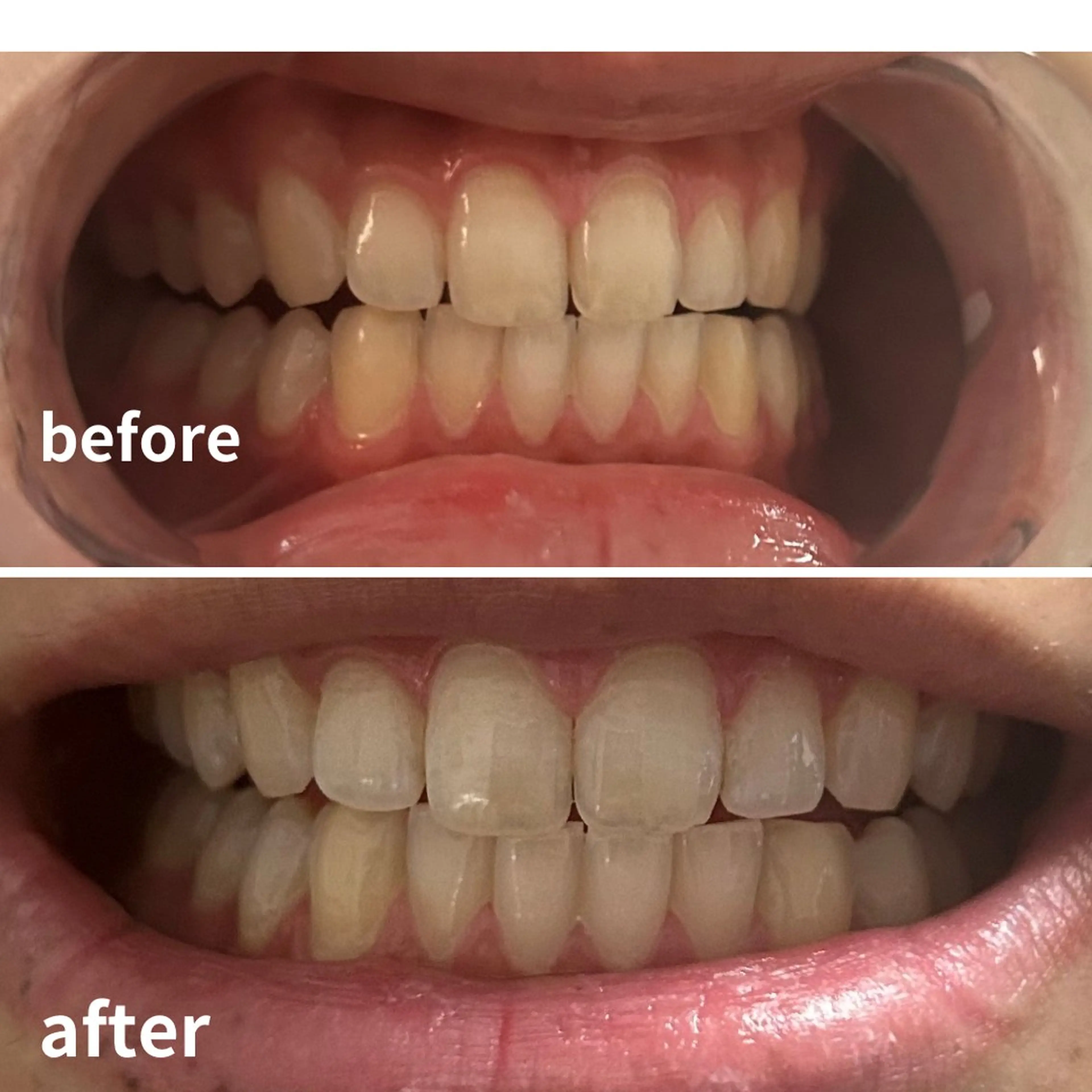 メンズ その他 エマニエル USAのエステ・リラクイメージ