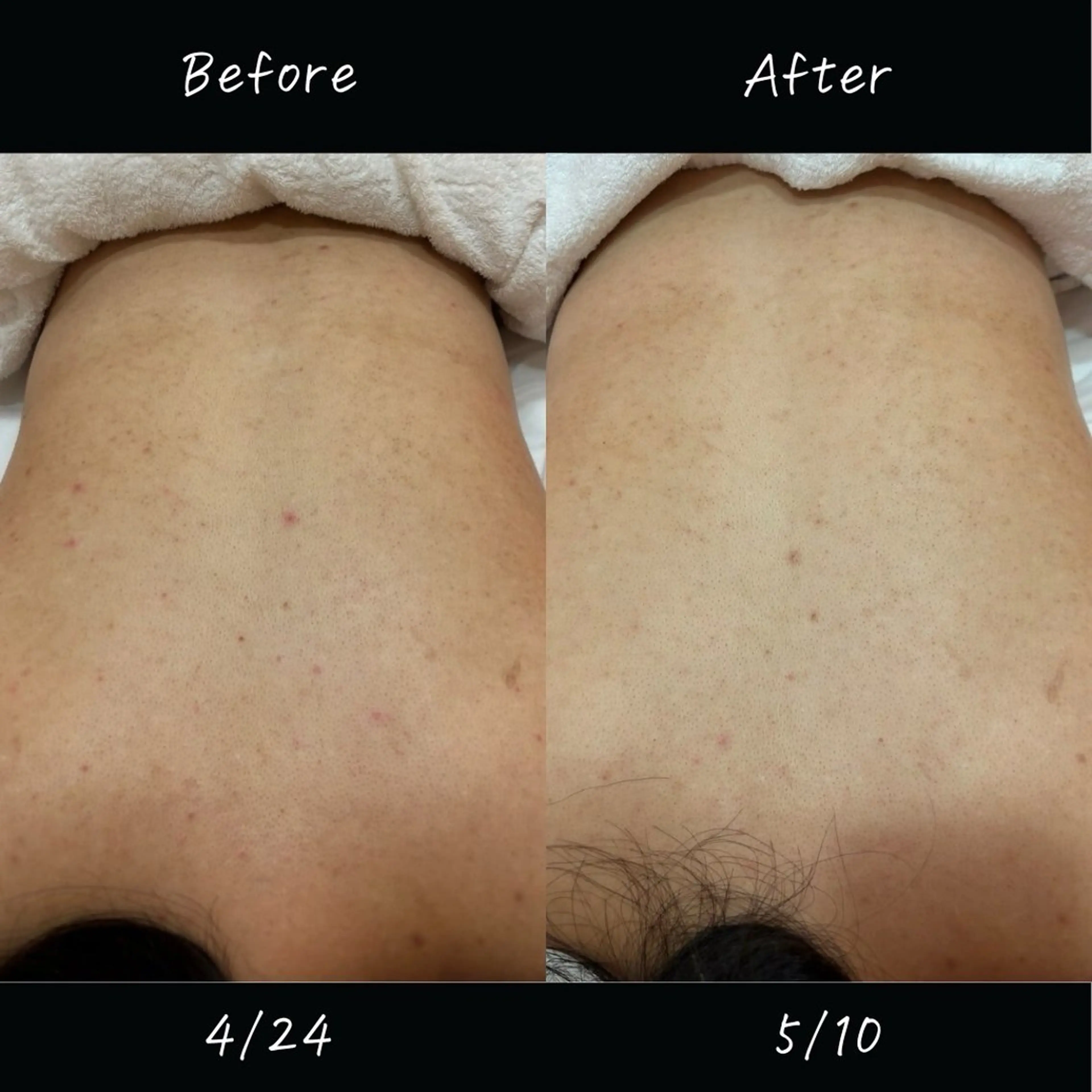 中井 小春のエステ・リラクイメージ