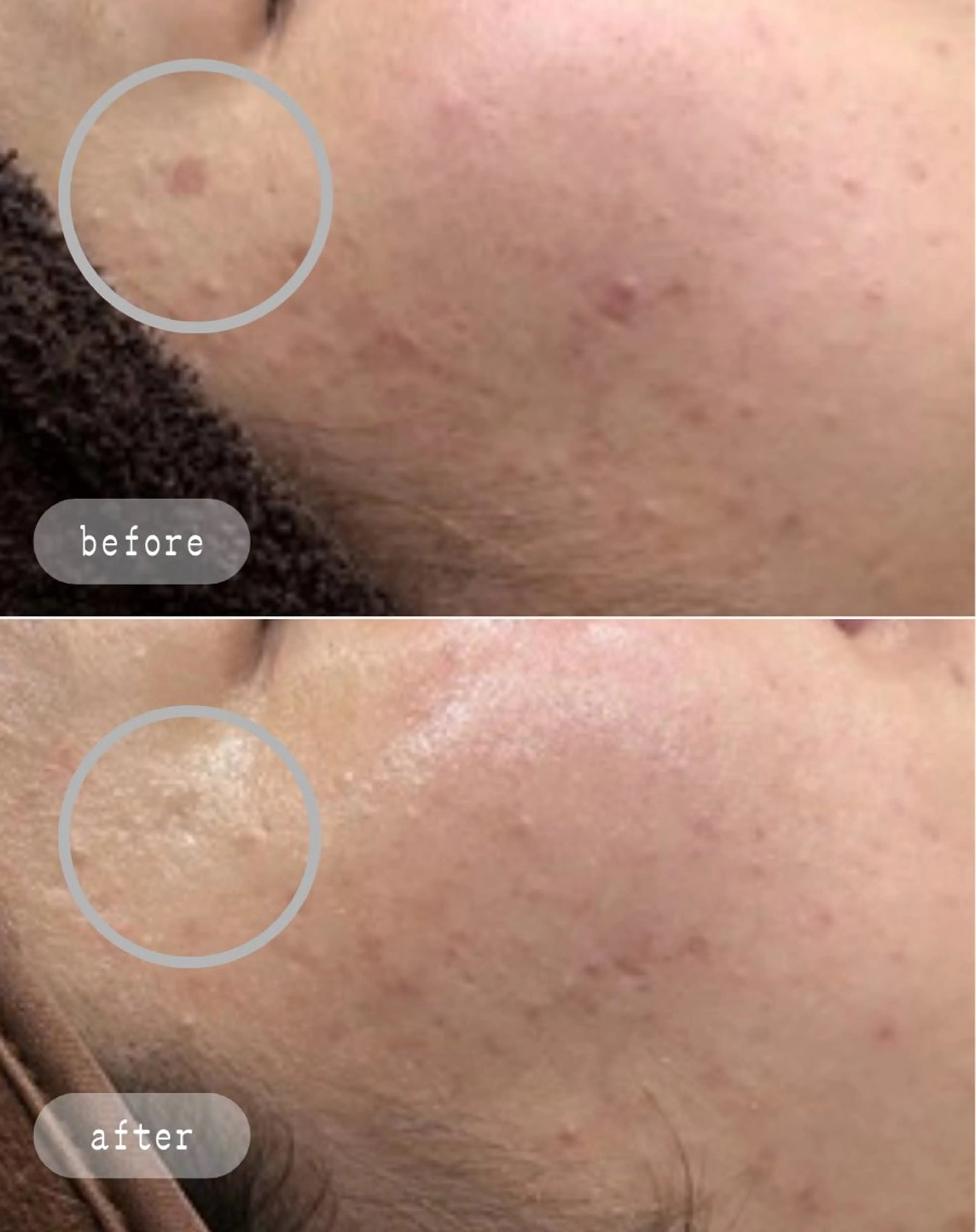 エステ LaVibe ann.のエステ・リラクイメージ