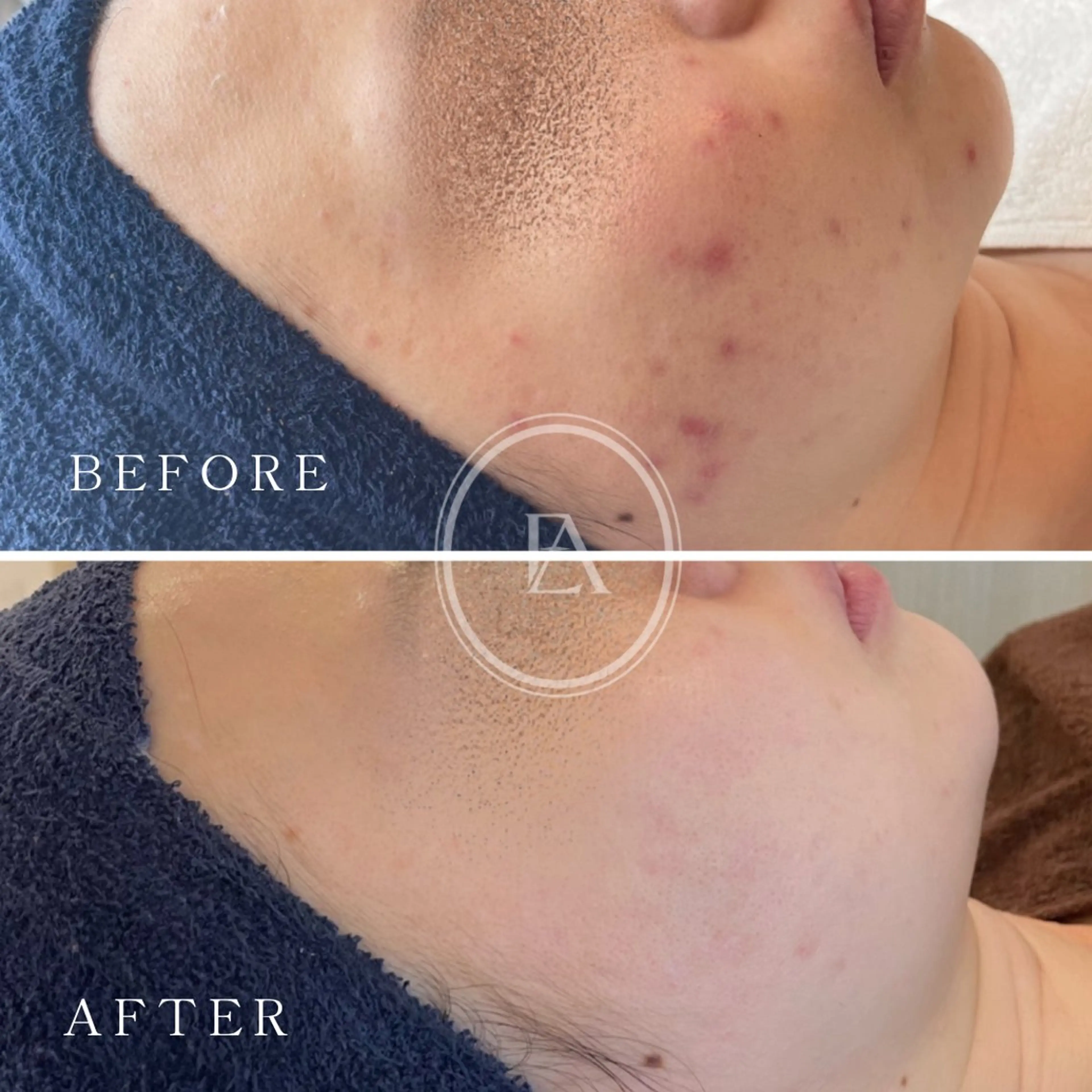 エステ エストリア 所沢店のエステ・リラクイメージ