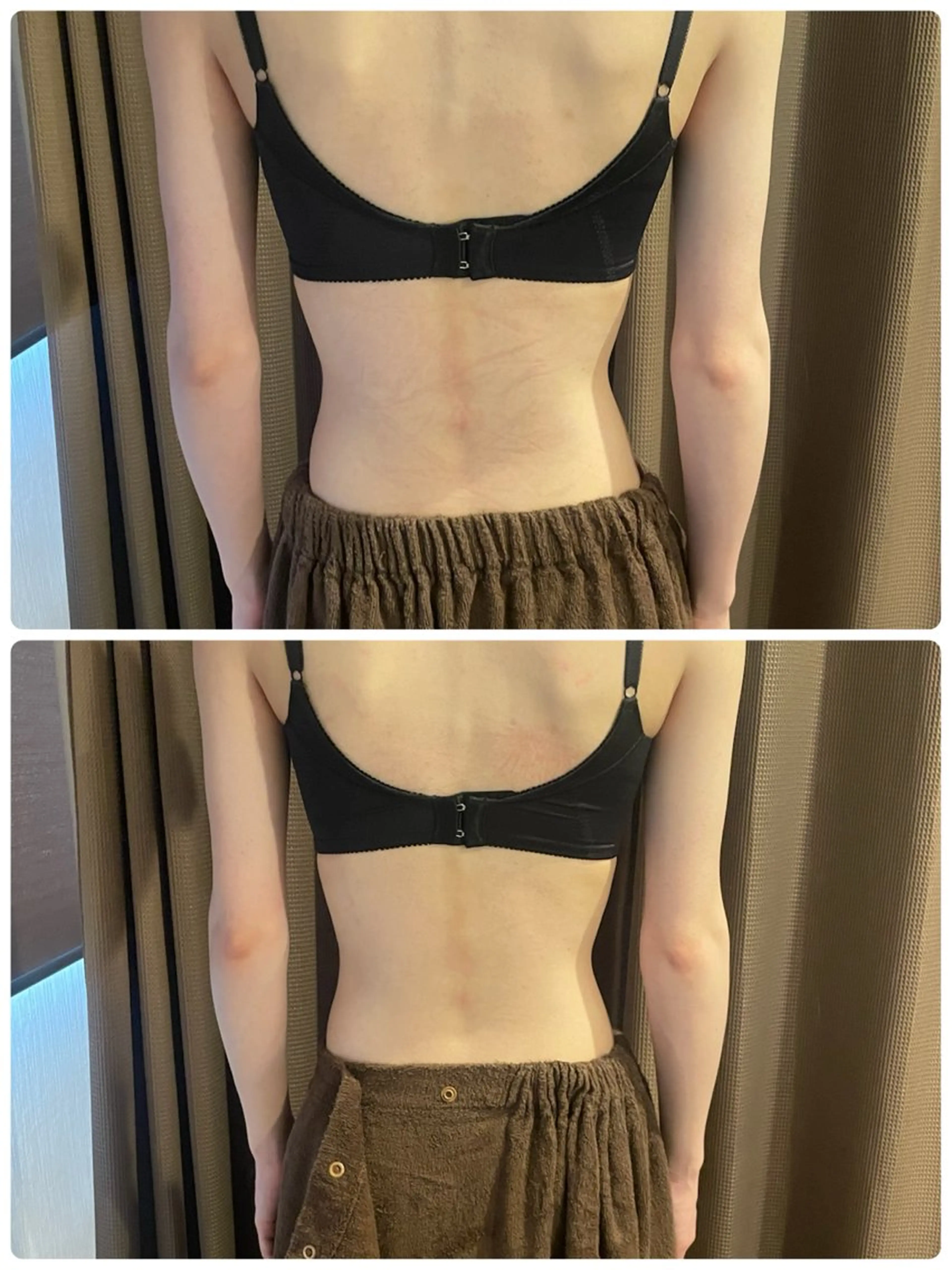 美人スイッチdiet スーパージェクションのその他イメージ